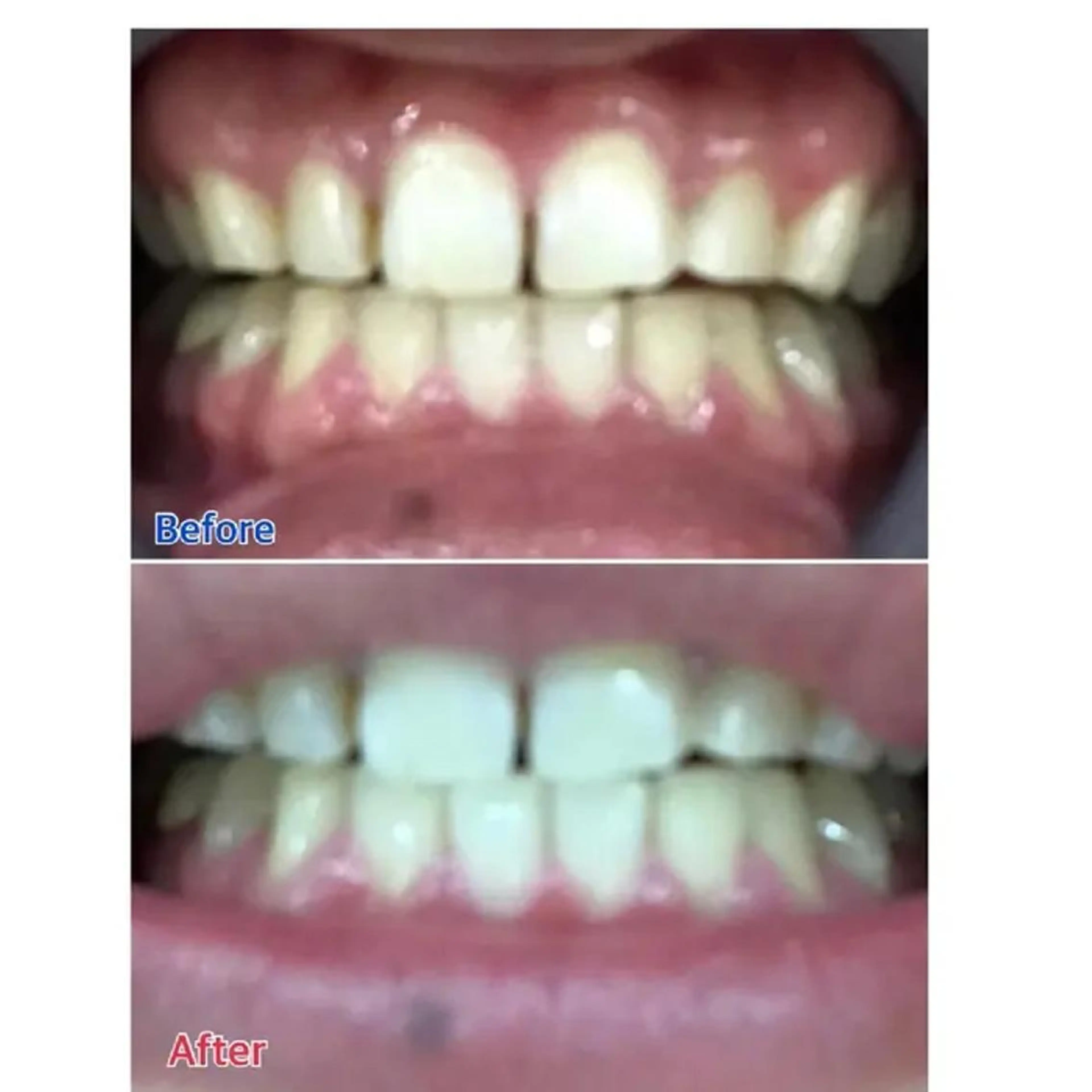 M渋谷店所属・Ｍ渋谷 ホワイトニングのその他イメージ