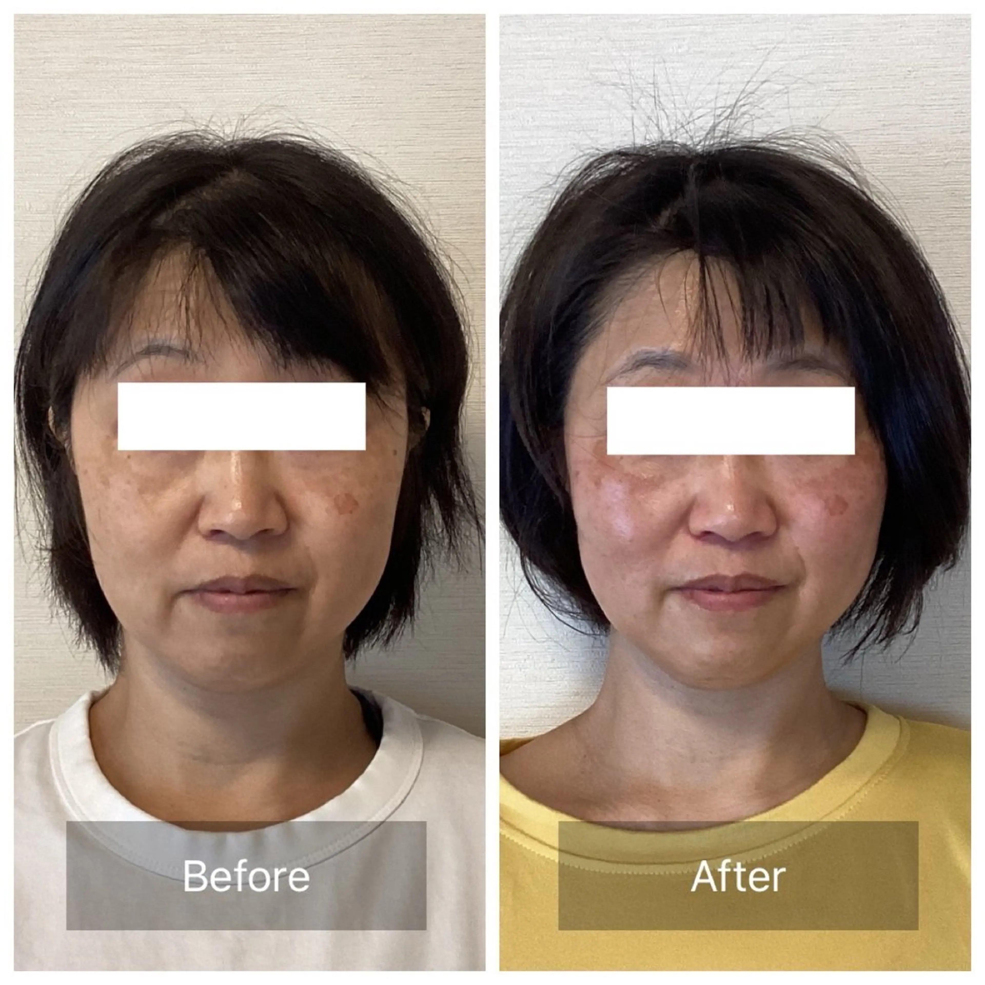 エステ リラク ルコナビューティ所属・小顔・歪み専門　井元 朋子のエステ・リラクイメージ