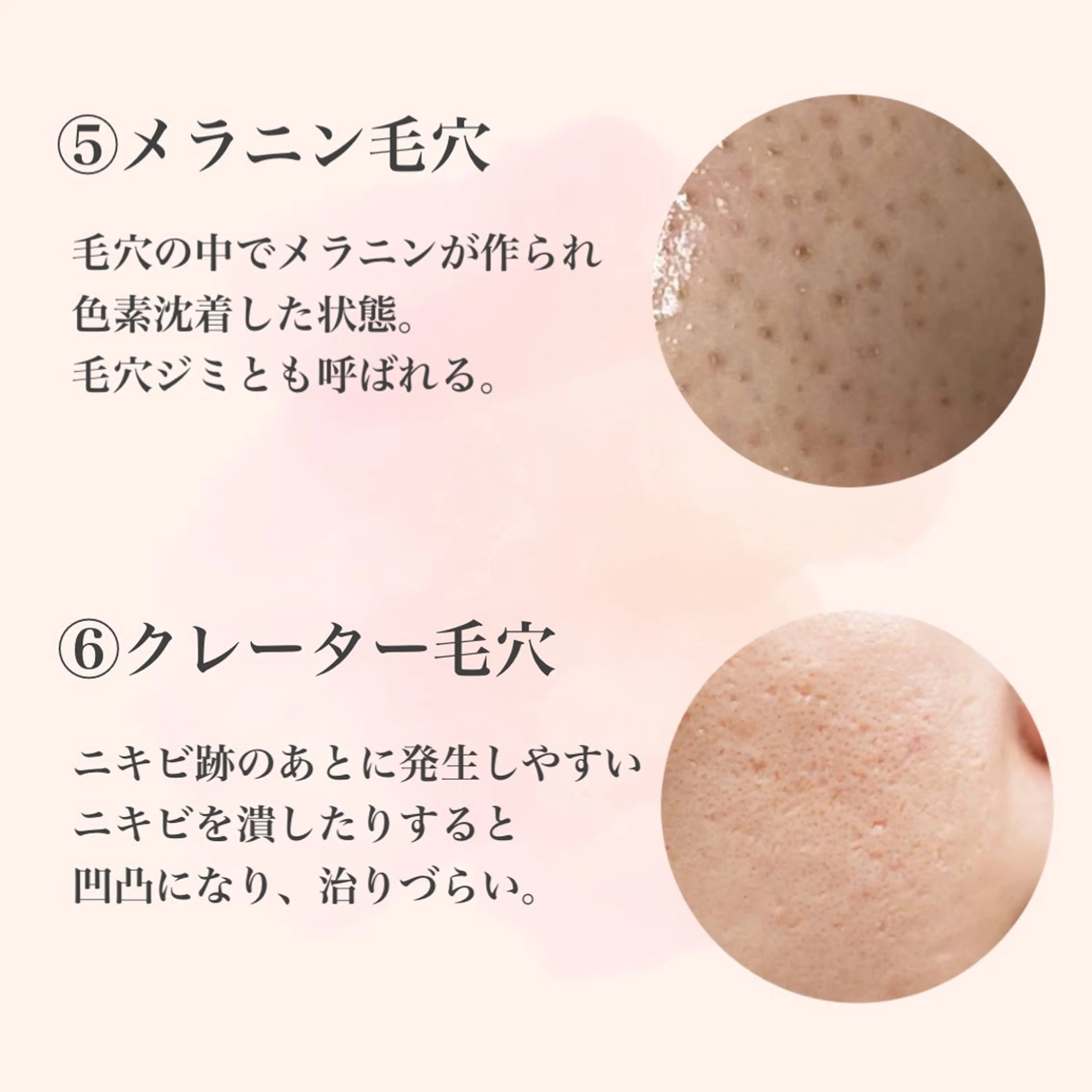 ハーブピーリング専門 muro.のエステ・リラクイメージ