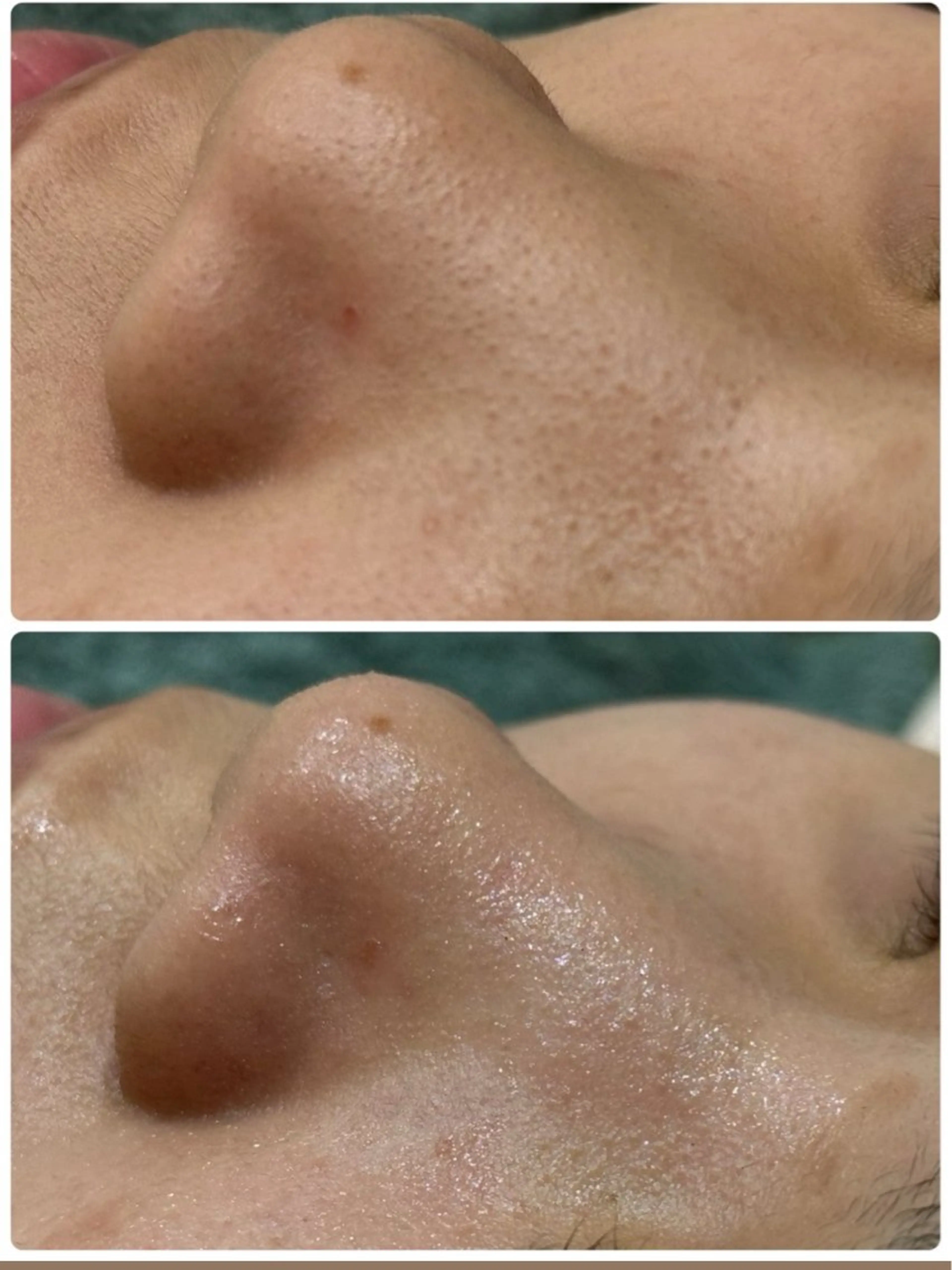 美肌脱毛サロン muroのエステ・リラクイメージ