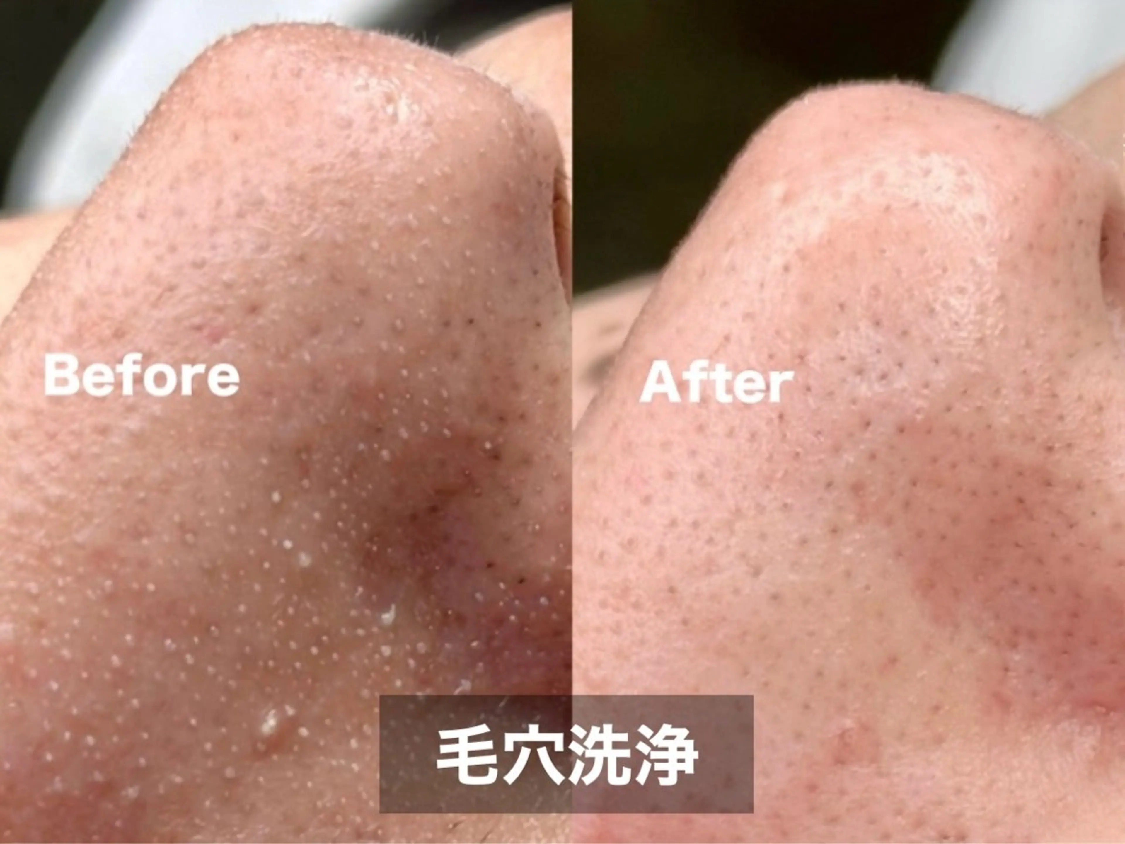 メンズ ONLY CARE by Vingt-cinq所属・オンリーケア バイヴァンサンクの眉毛・アイブロウイメージ