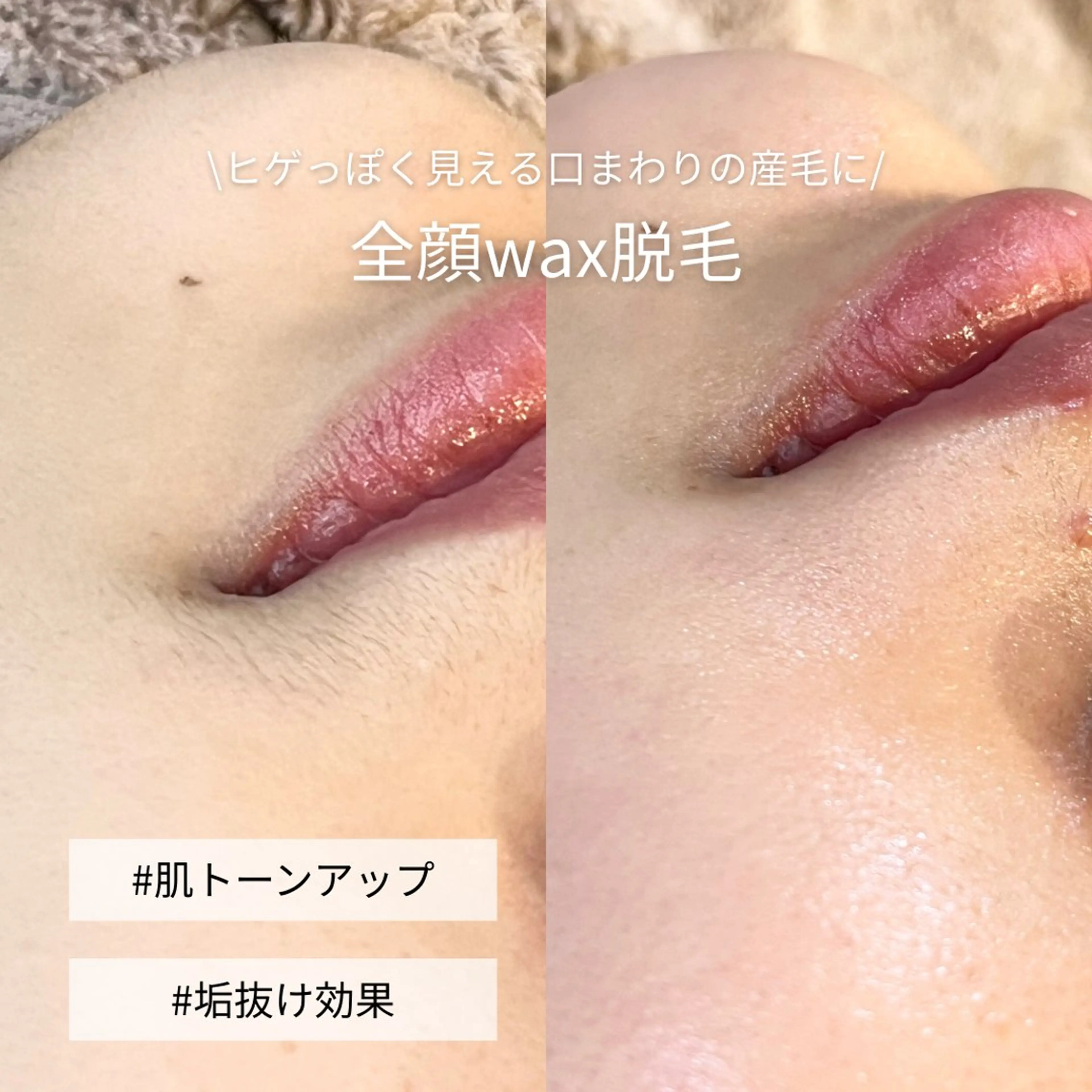 脱毛 EST BEAUTY所属・顔ワックス脱毛/ ハーブピーリングのエステ・リラクイメージ