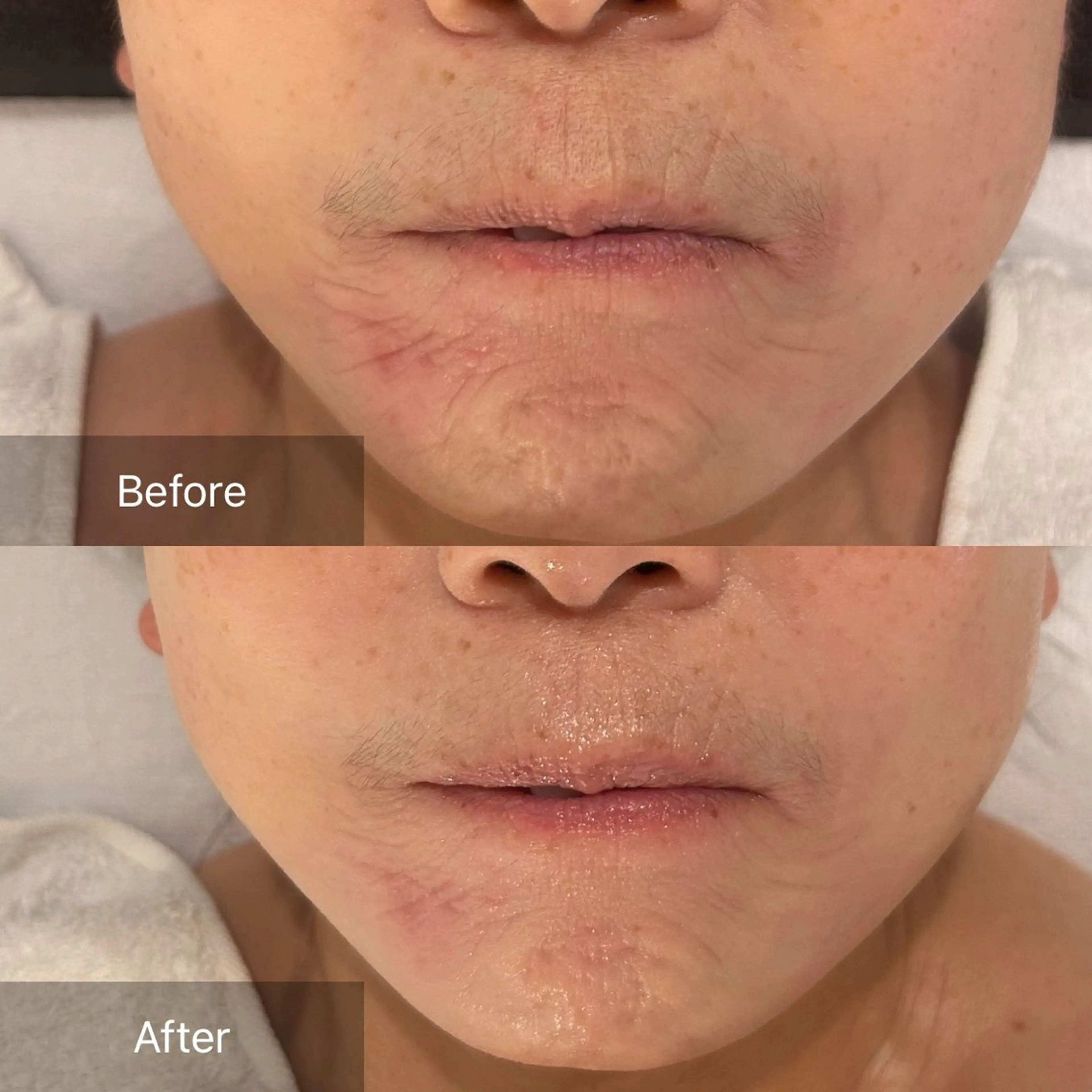 エステ mine.mマインエム所属・mine.mi マインエムのエステ・リラクイメージ