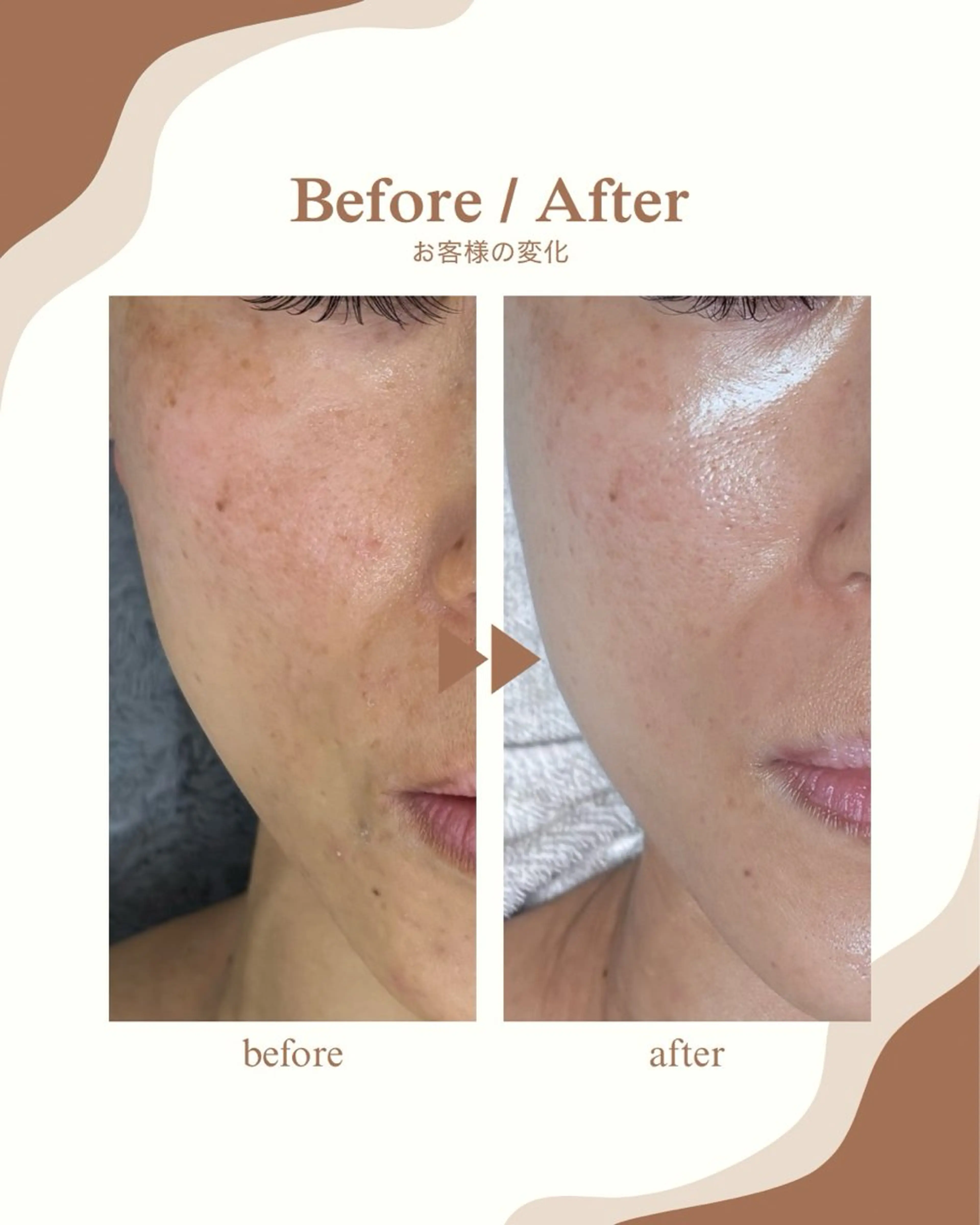 肌育フェイシャル🌿 noel🌿SAKIのエステ・リラクイメージ