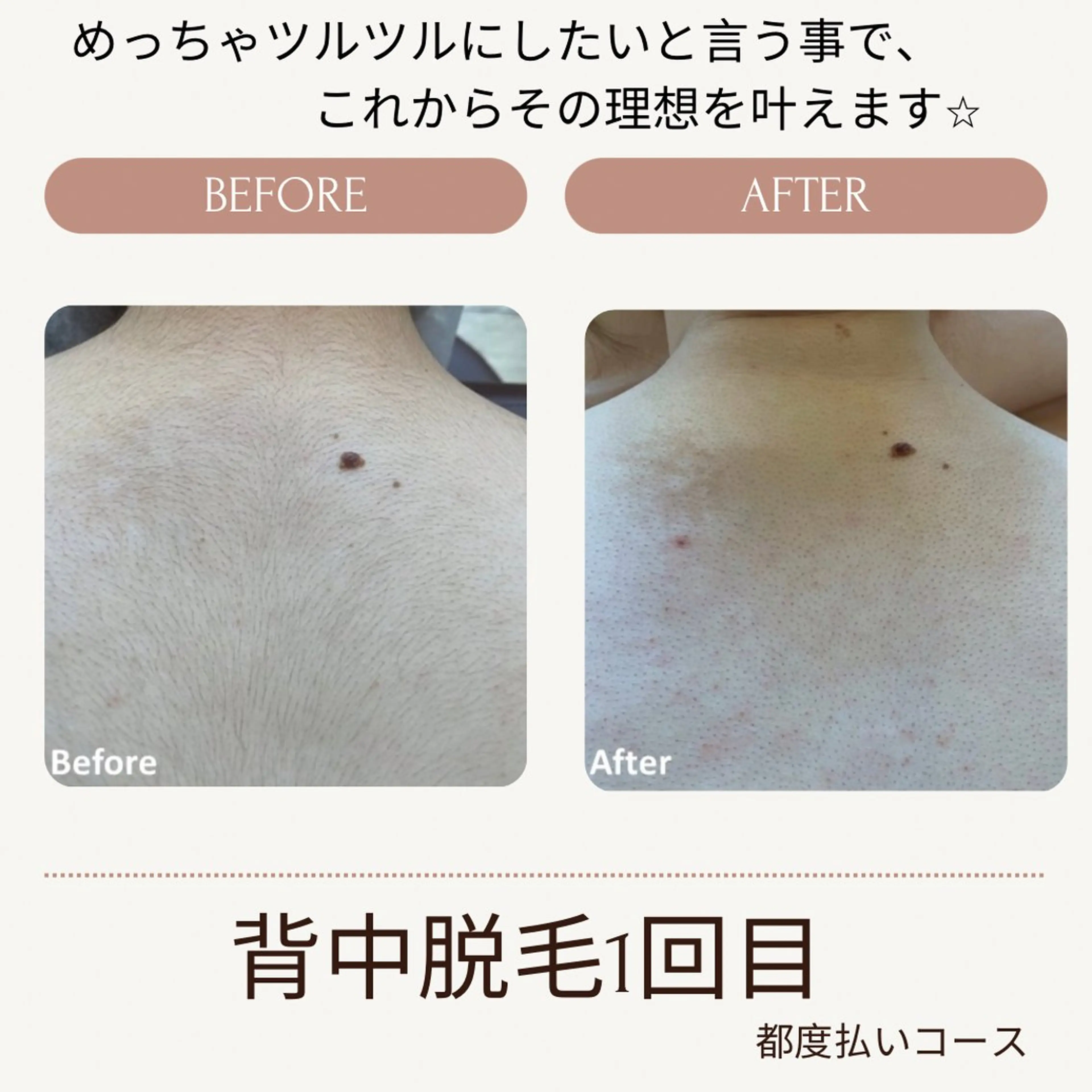 VANILLA SKY所属・VANILLA SKYのエステ・リラクイメージ