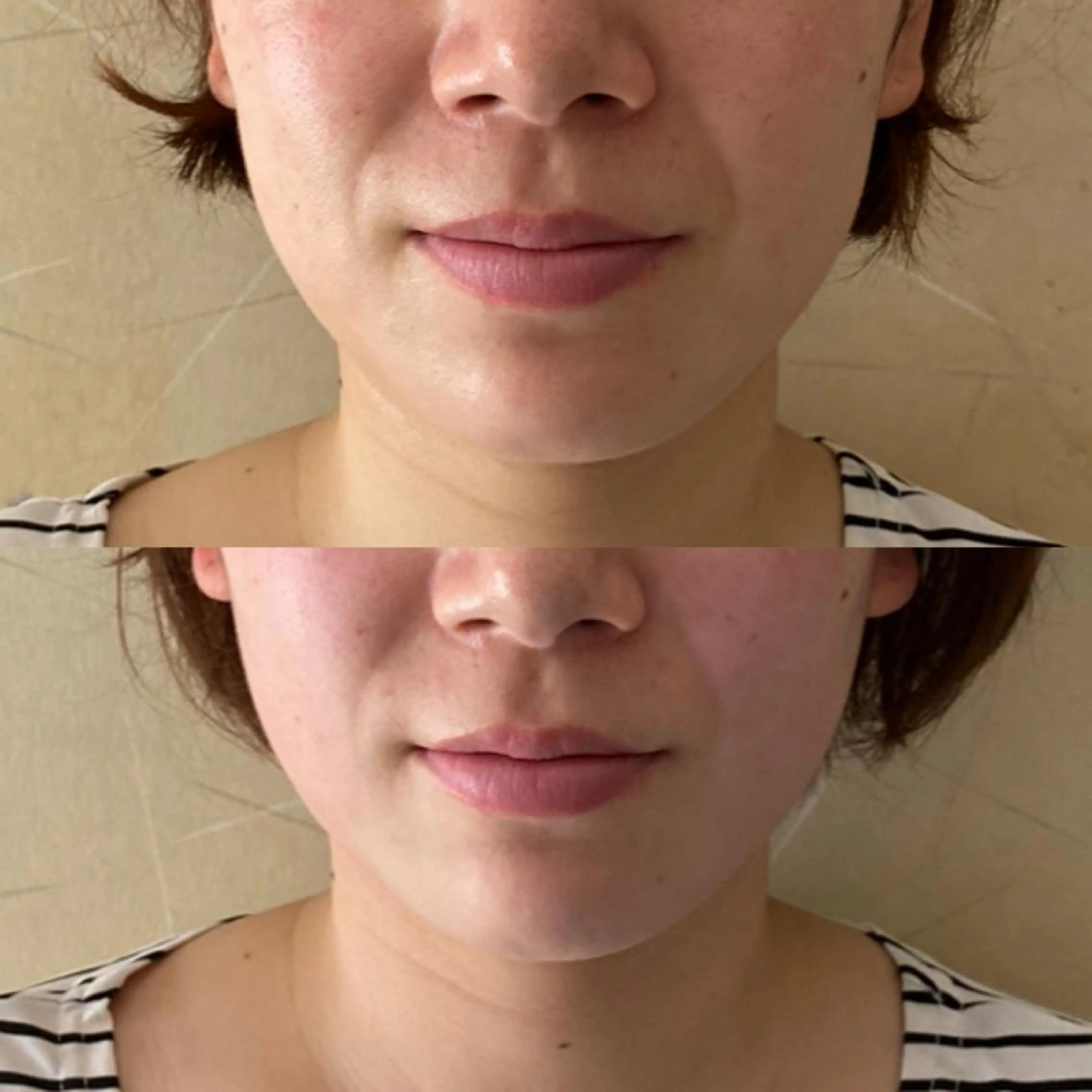 小顔SALON   MAREA所属・MAREA 小顔SALONのエステ・リラクイメージ