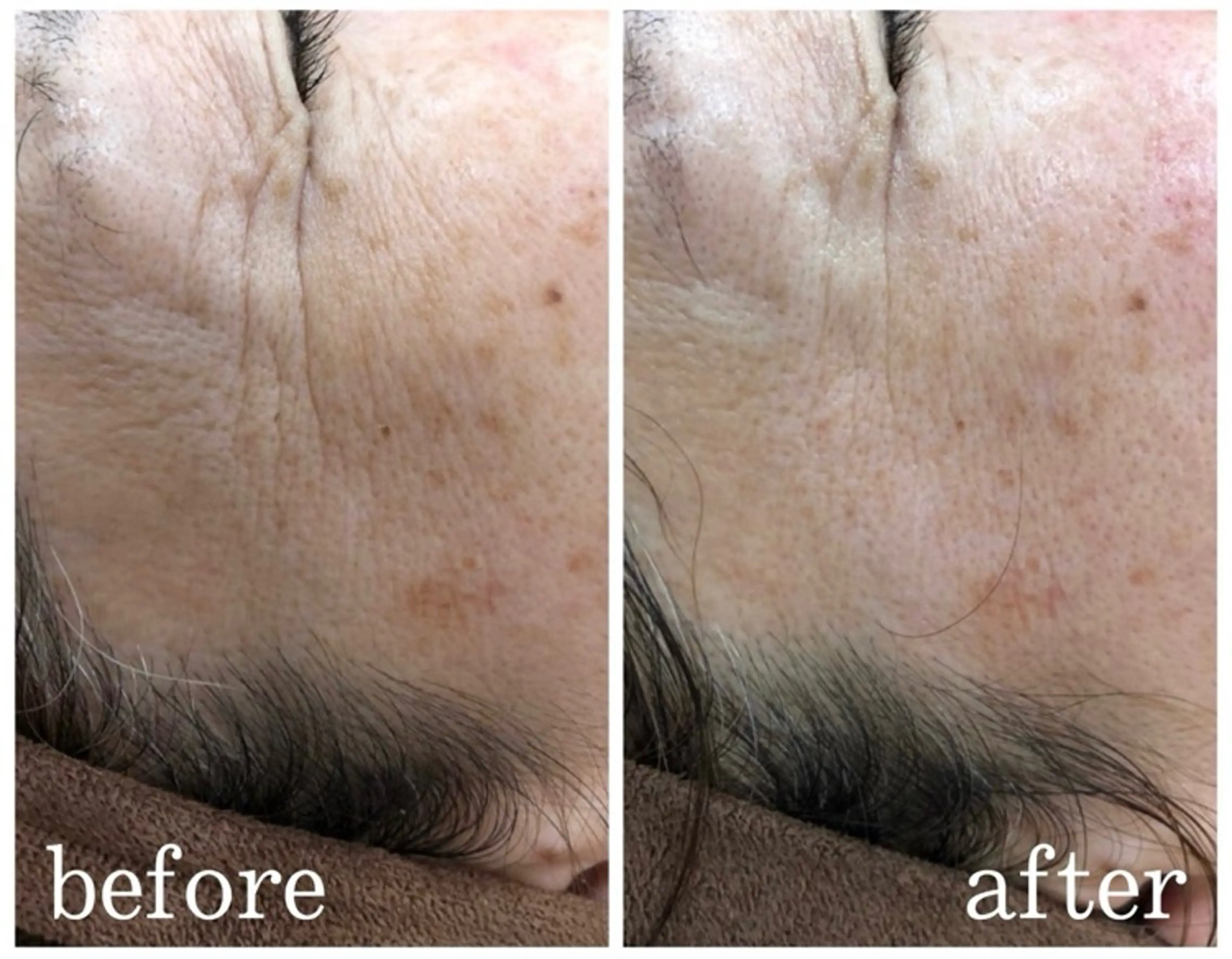 エステティック ロッカのエステ・リラクイメージ