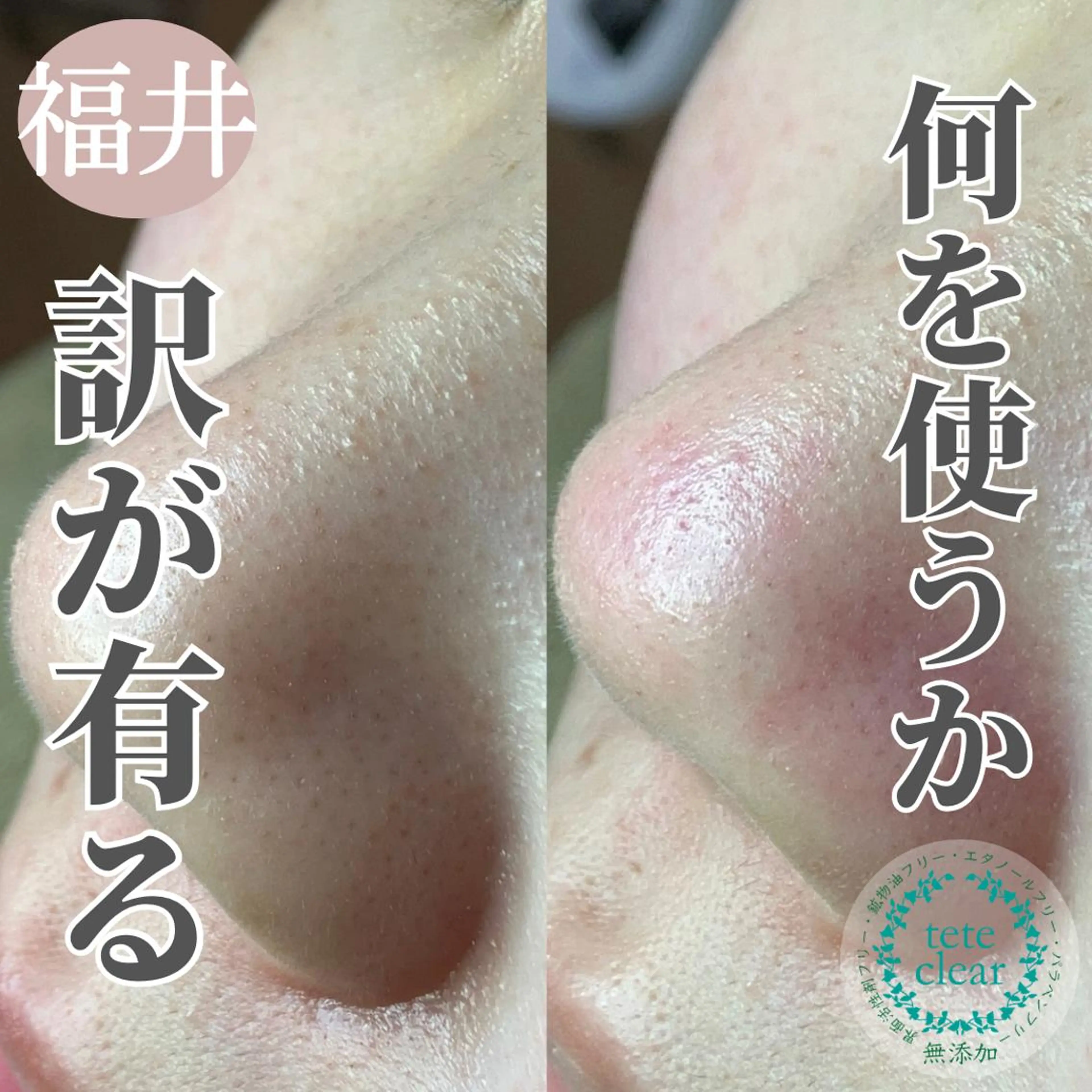 毛穴肌質ケアサロン Yourmeユアミーのエステ・リラクイメージ