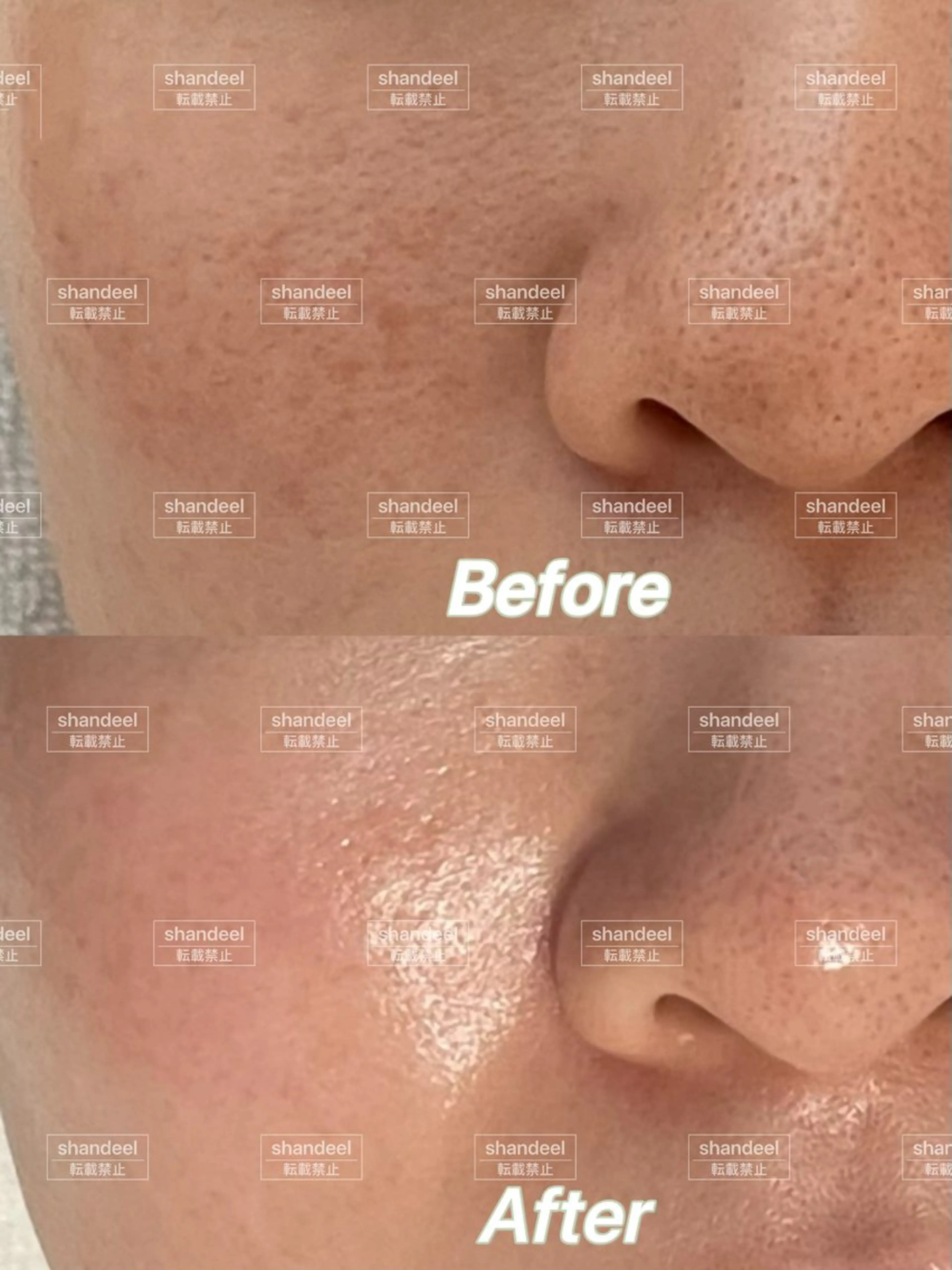 肌管理専門店 Shandeelのエステ・リラクイメージ