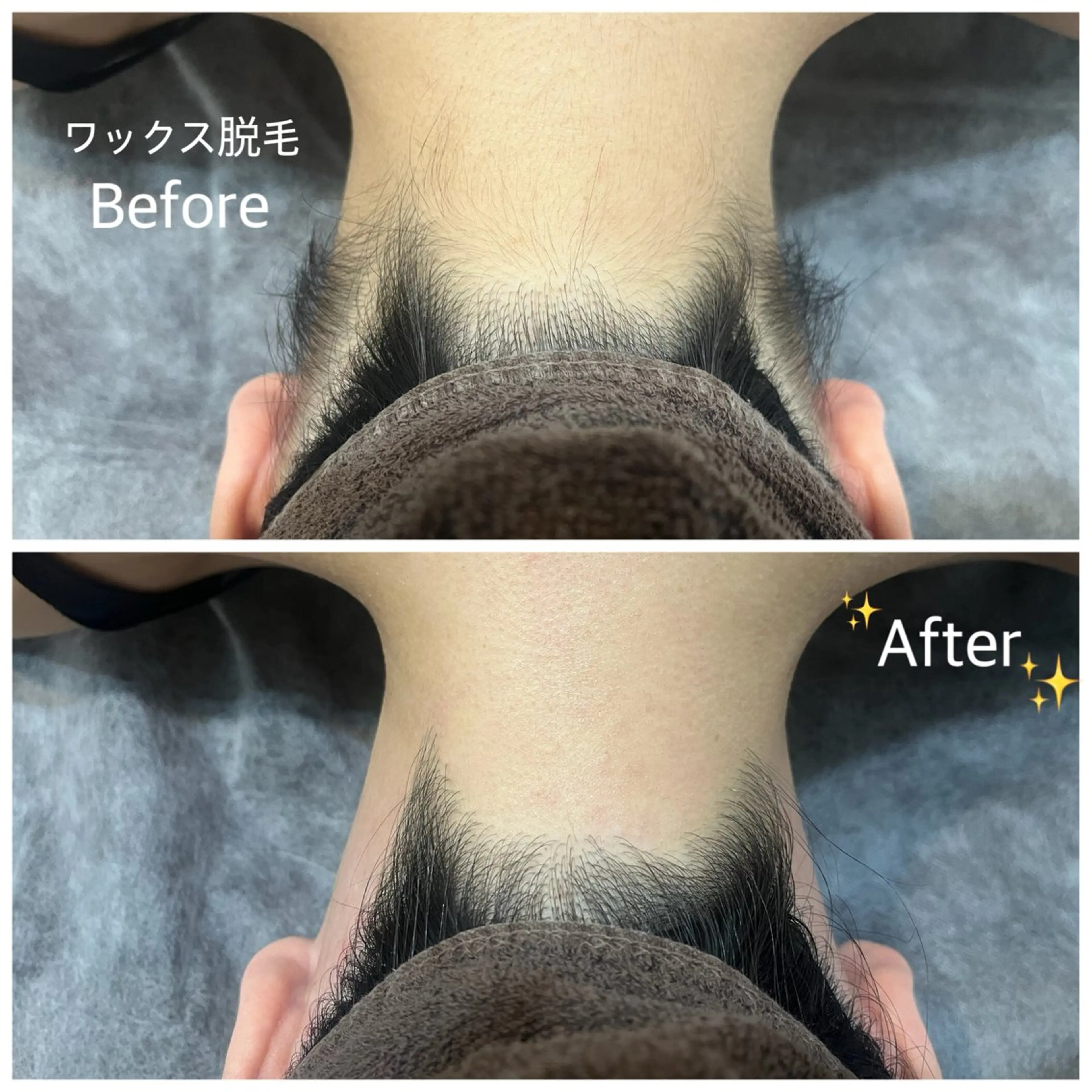 脱毛 脱毛サロン fam.豊澤柚良のエステ・リラクイメージ