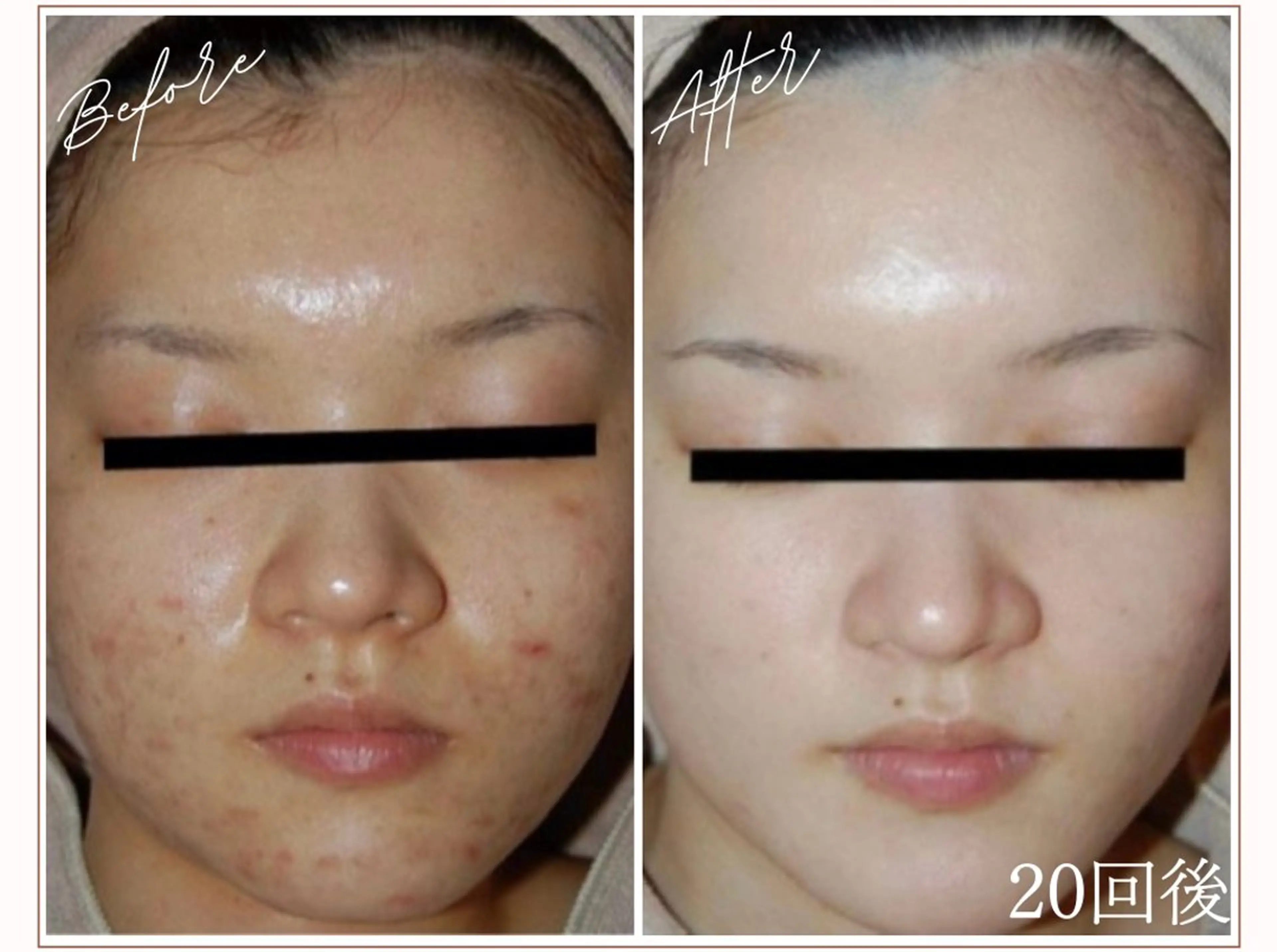 MYubelle ミューベルのエステ・リラクイメージ