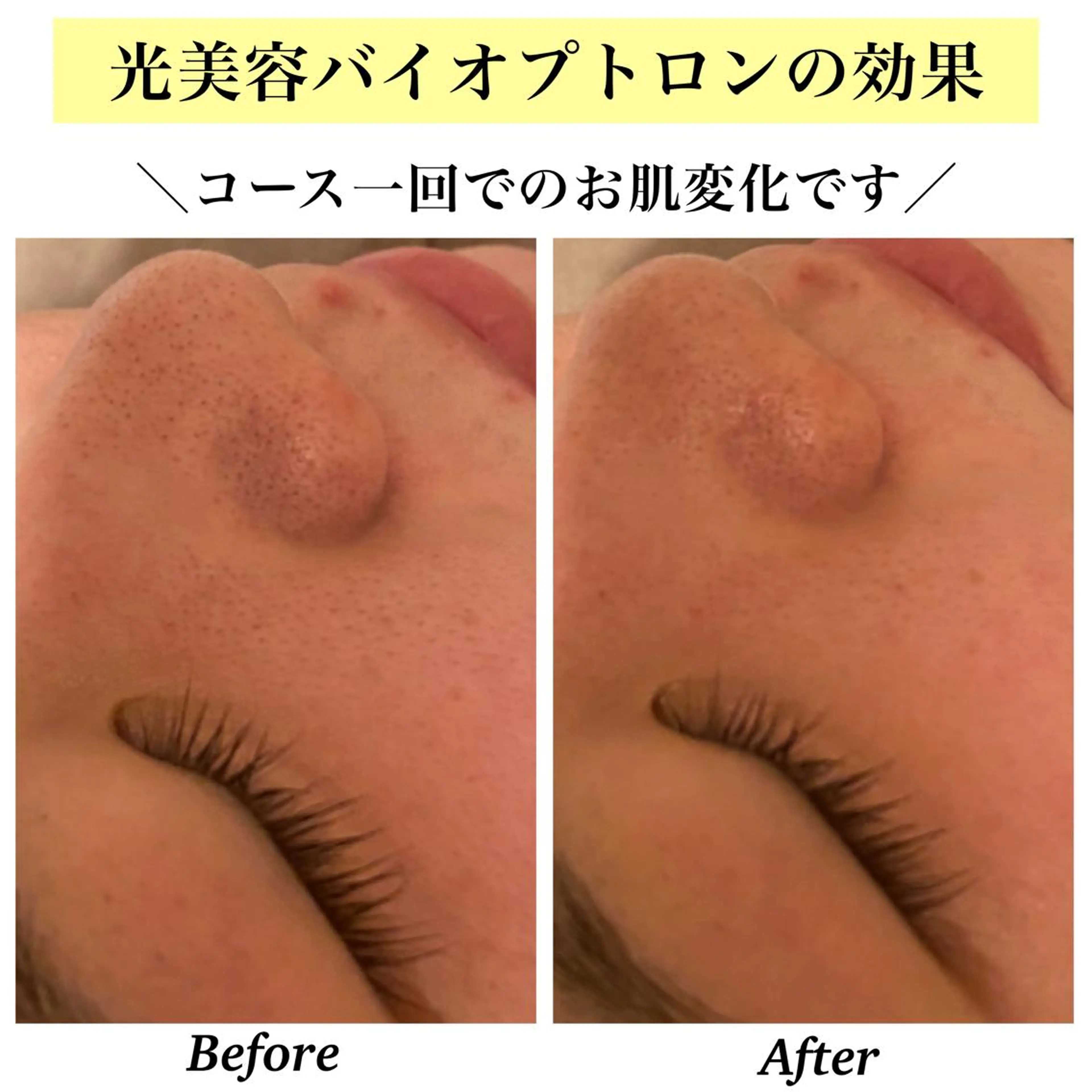 Bellesthe （ベルエステ）のエステ・リラクイメージ