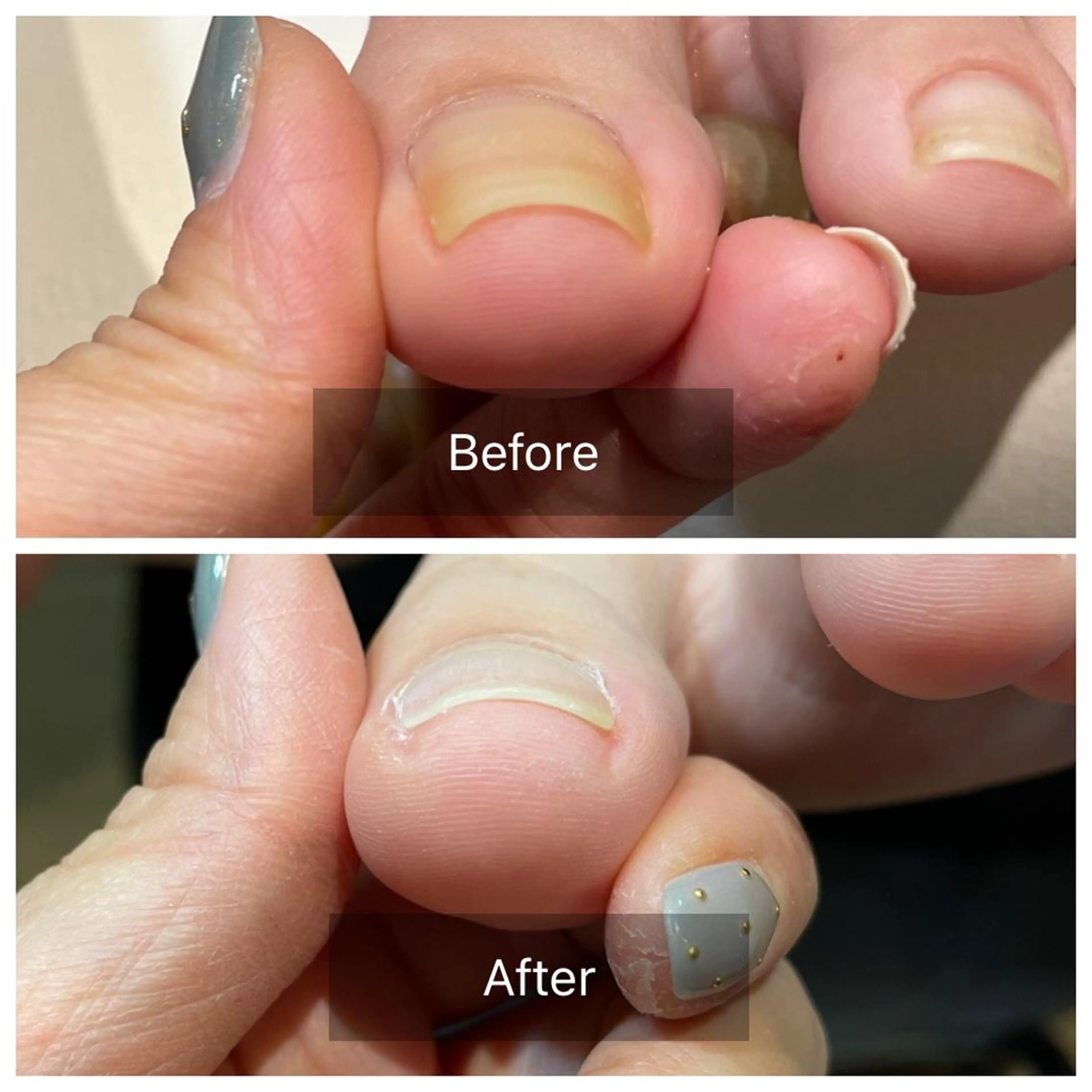 ネイル cachette mのネイルデザイン