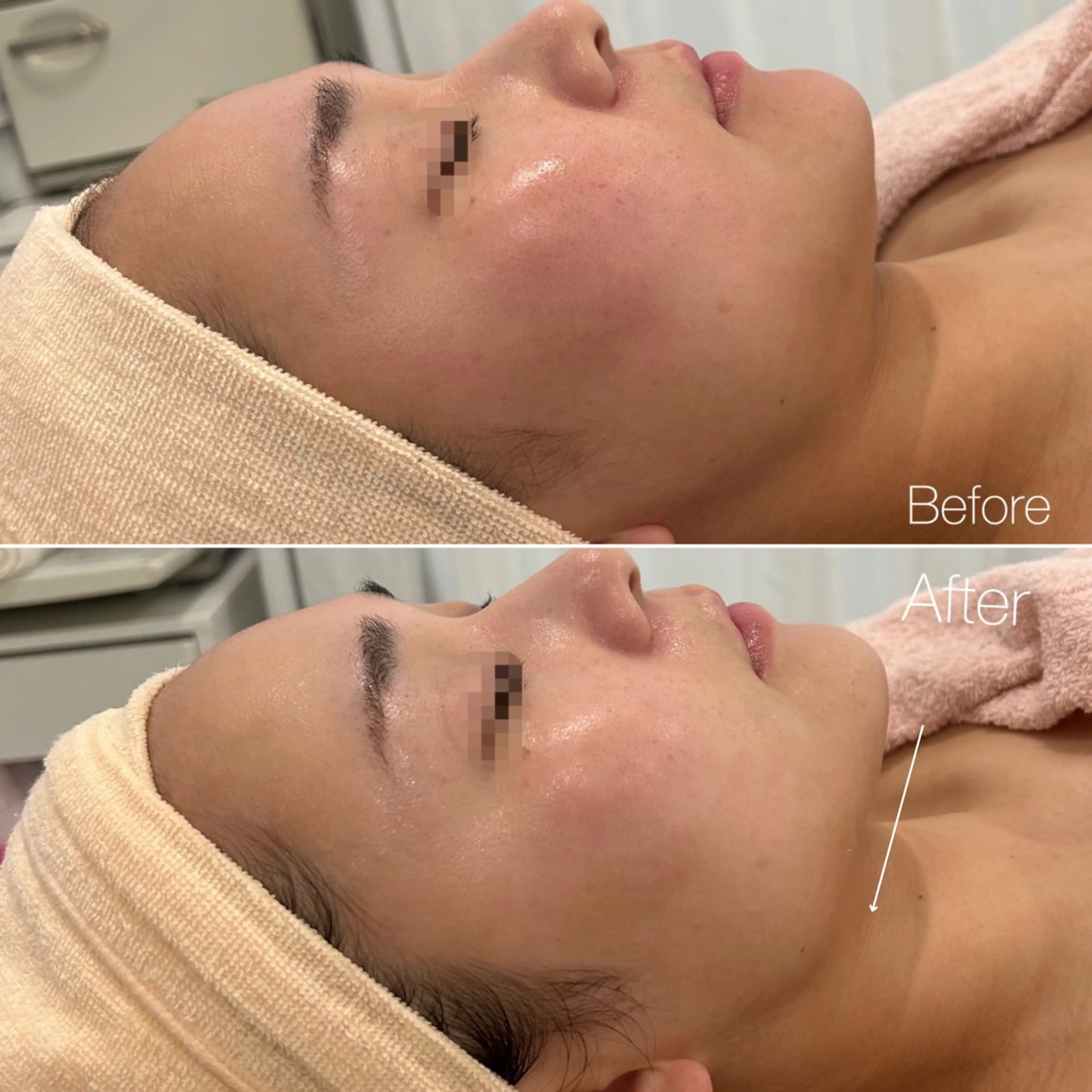 〈etre〉トータルビューティーサロン所属・etre - 韓国肌管理 -のエステ・リラクイメージ