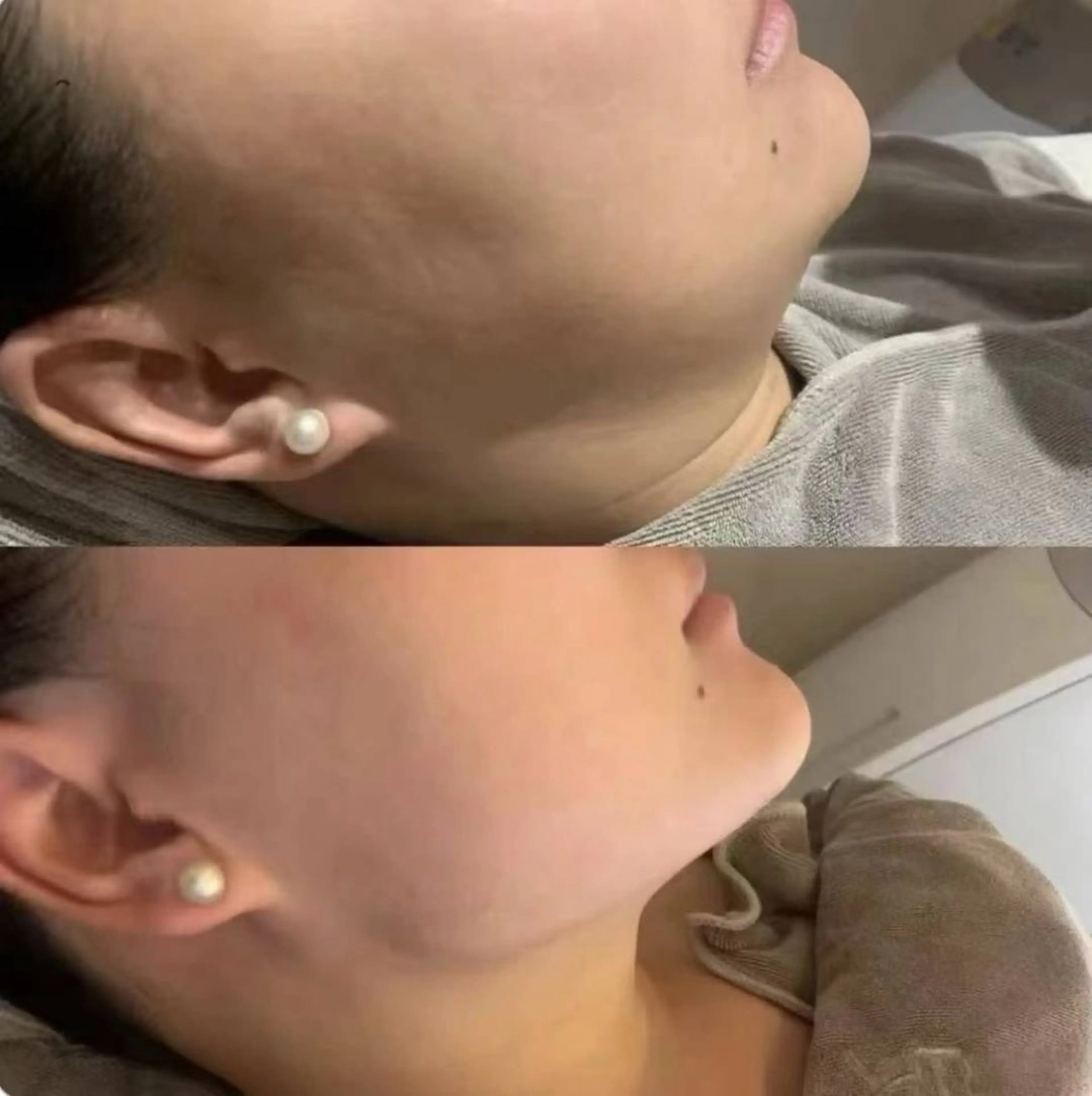 マツエク・マツパ エステ aliaハイフ&水光ジェットサロン所属・aliaハーブ水光店 エステティシャン募集のエステ・リラクイメージ