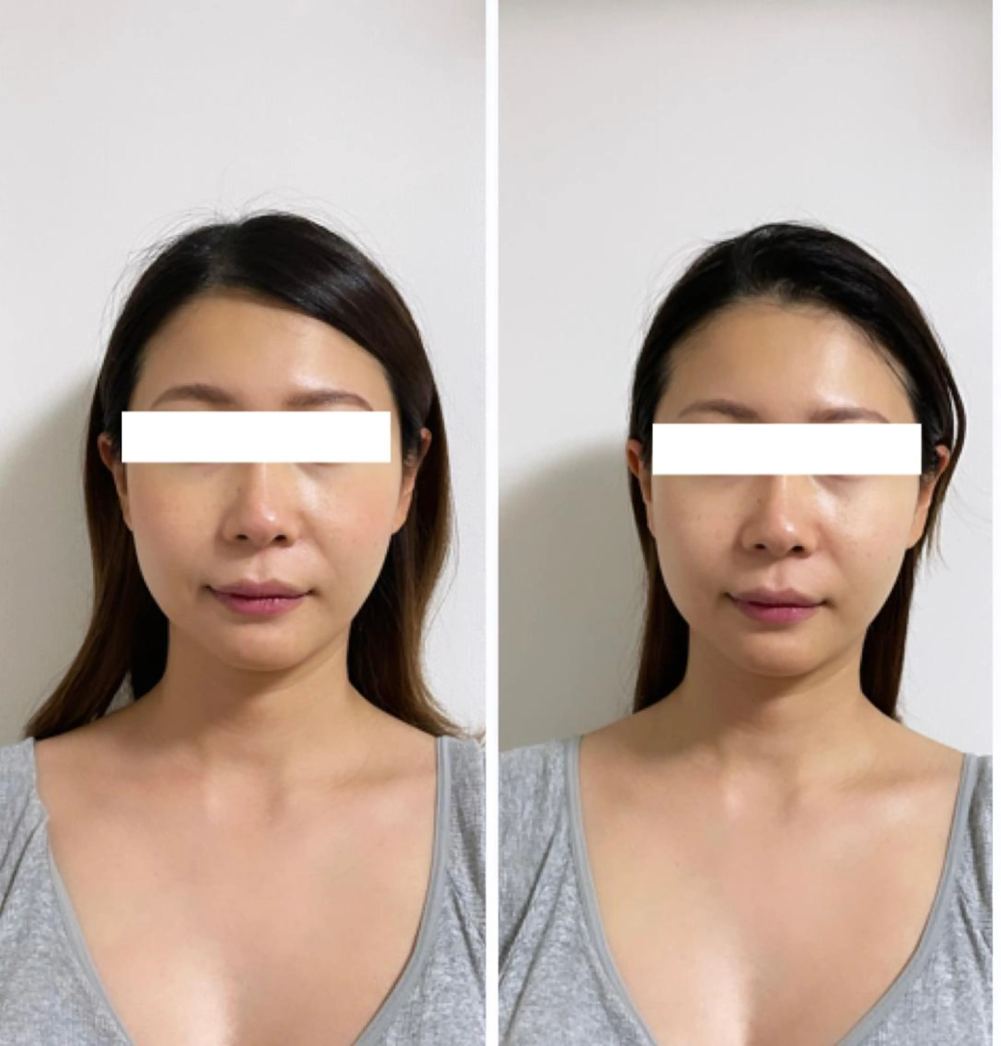 自律神経を整える フェイシャルエステのエステ・リラクイメージ