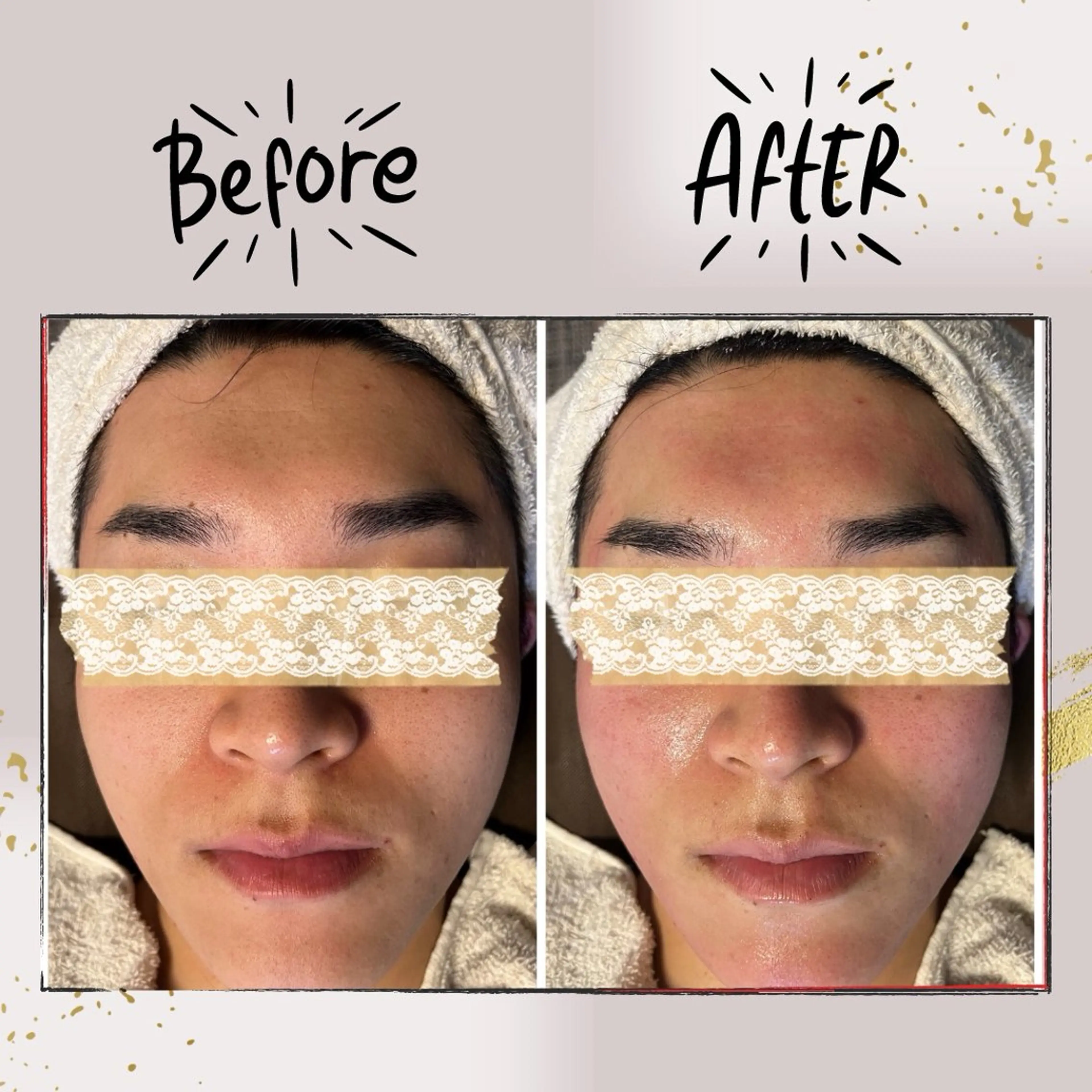 エステ リラク ピーリング専門店 Belluteのエステ・リラクイメージ