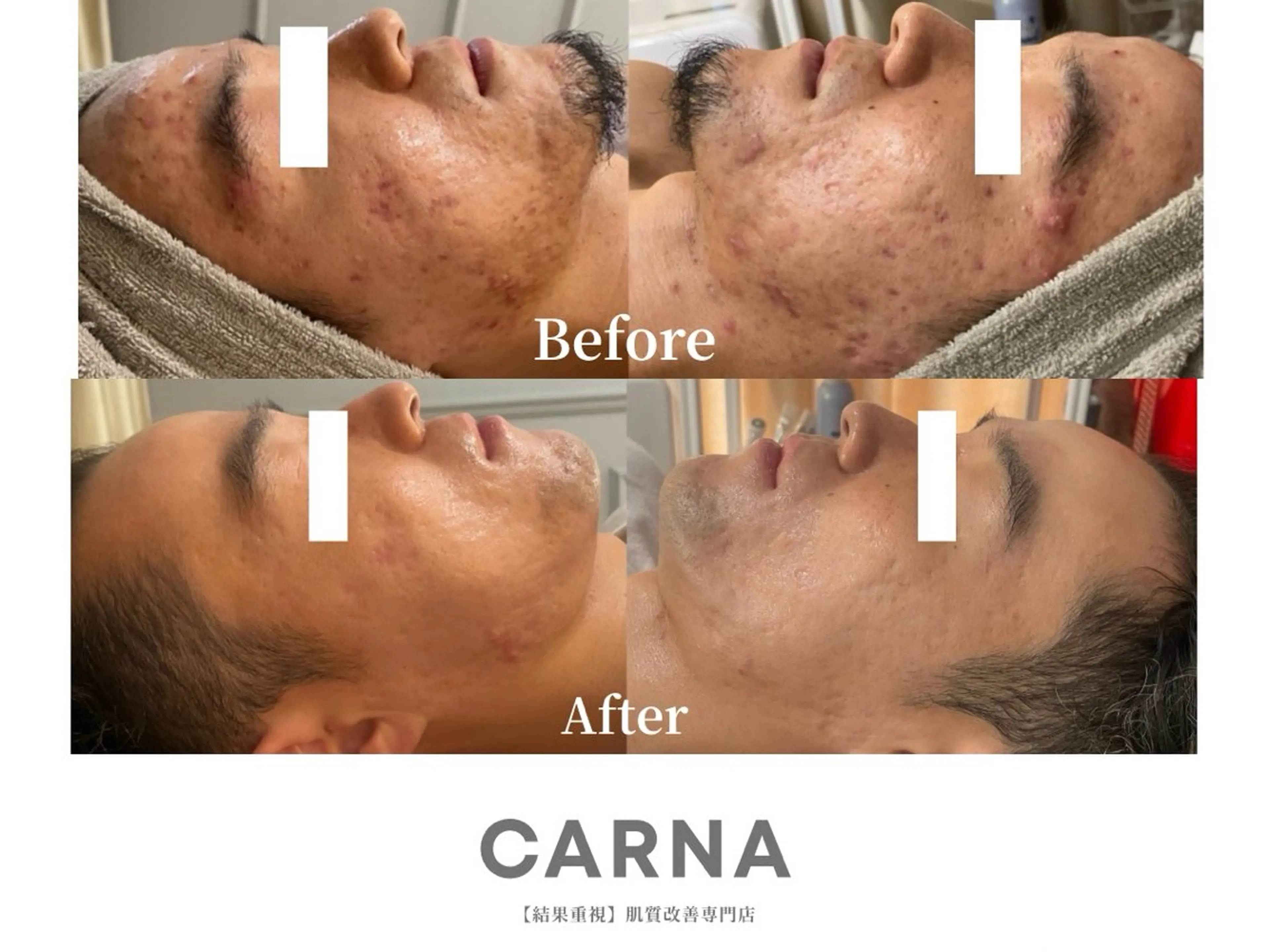 メンズ CARNA所属・【肌質改善専門店】 CARNAのエステ・リラクイメージ