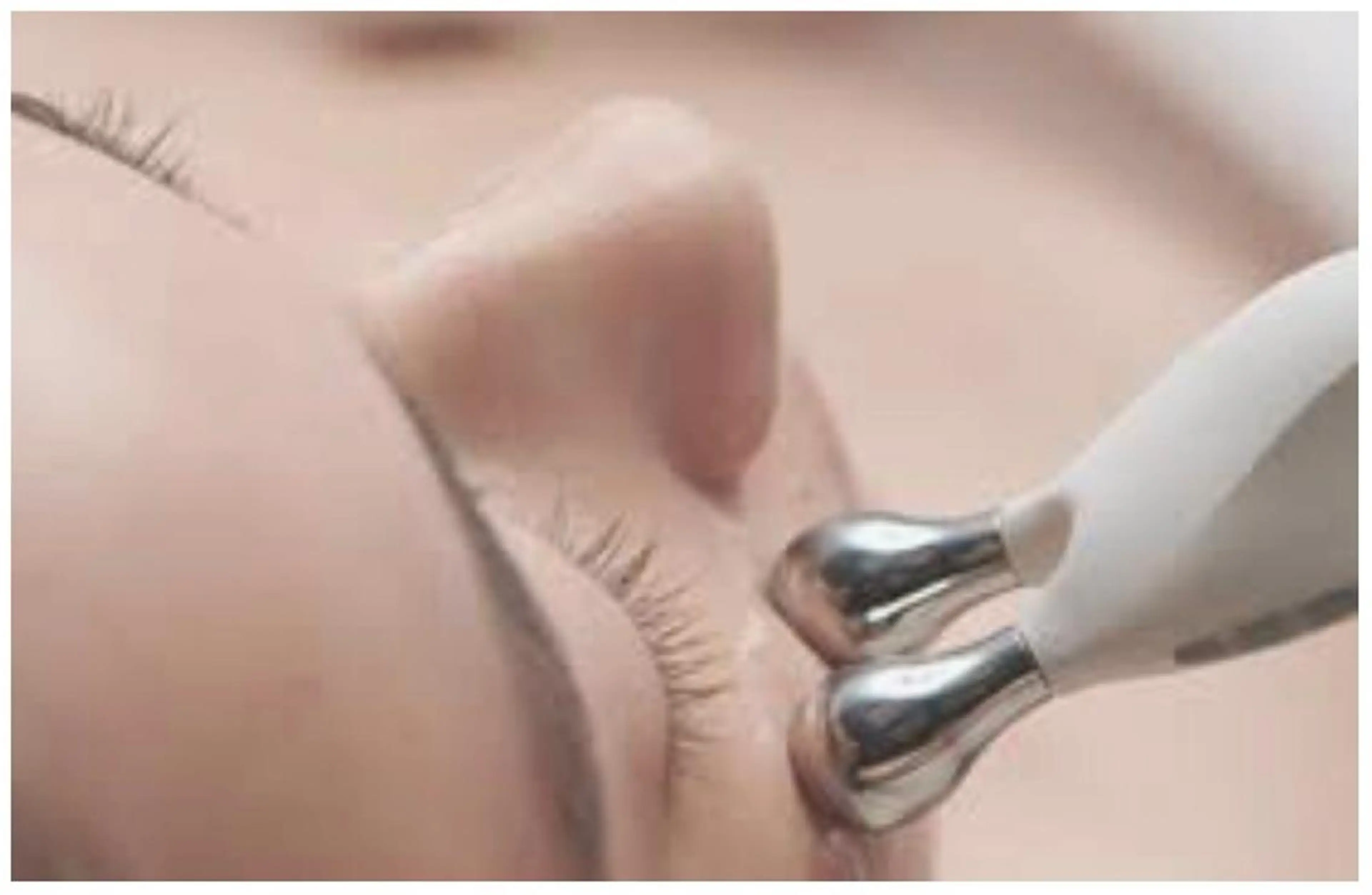 オプション・(サロン専用EMS）コアビューティーの写真