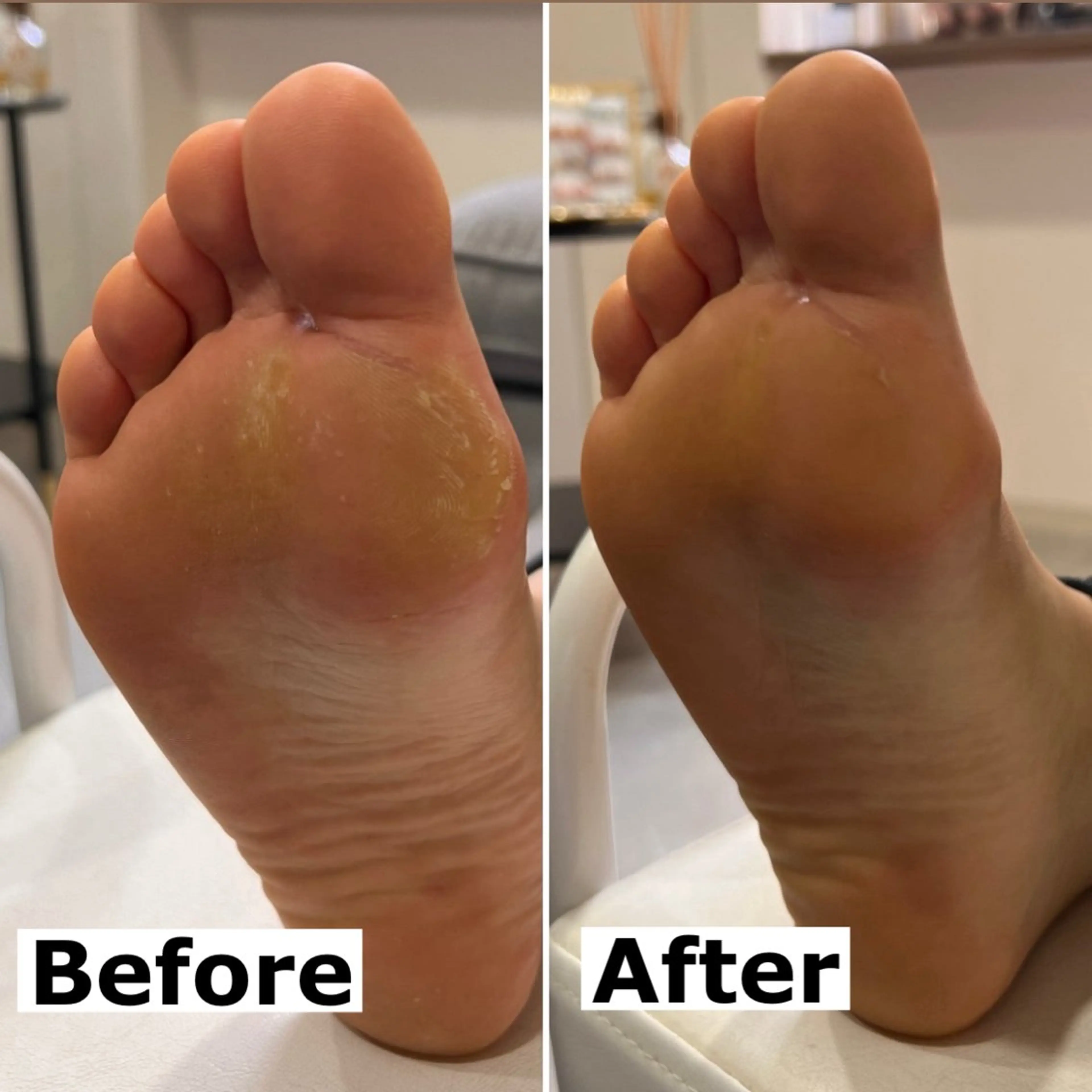 ネイル Mellow nail所属・巻爪無料モデル募集 ✨🦶MEGUMIのネイルデザイン