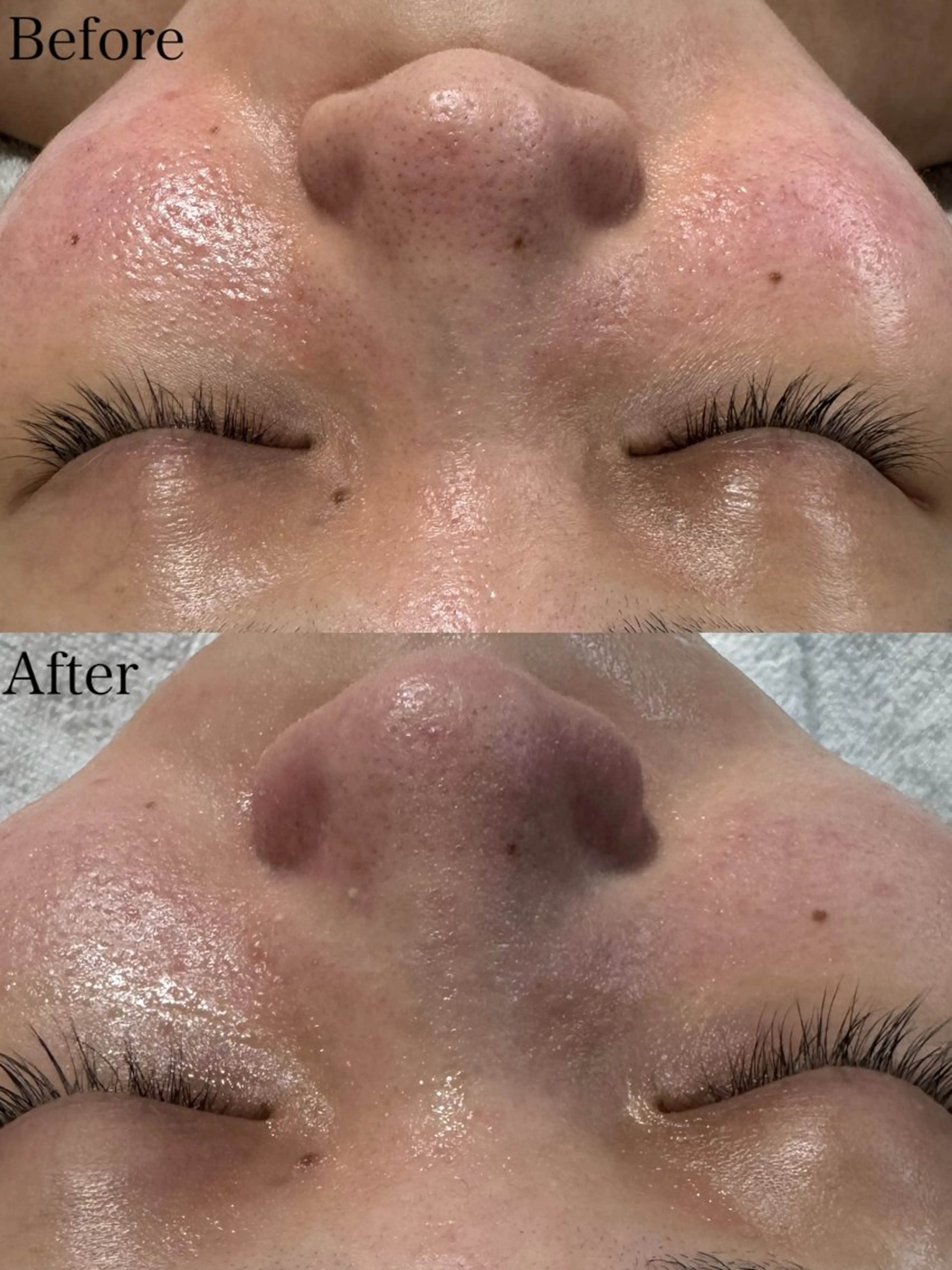 beautysalon LIMOA所属・松本 愛絵理のエステ・リラクイメージ