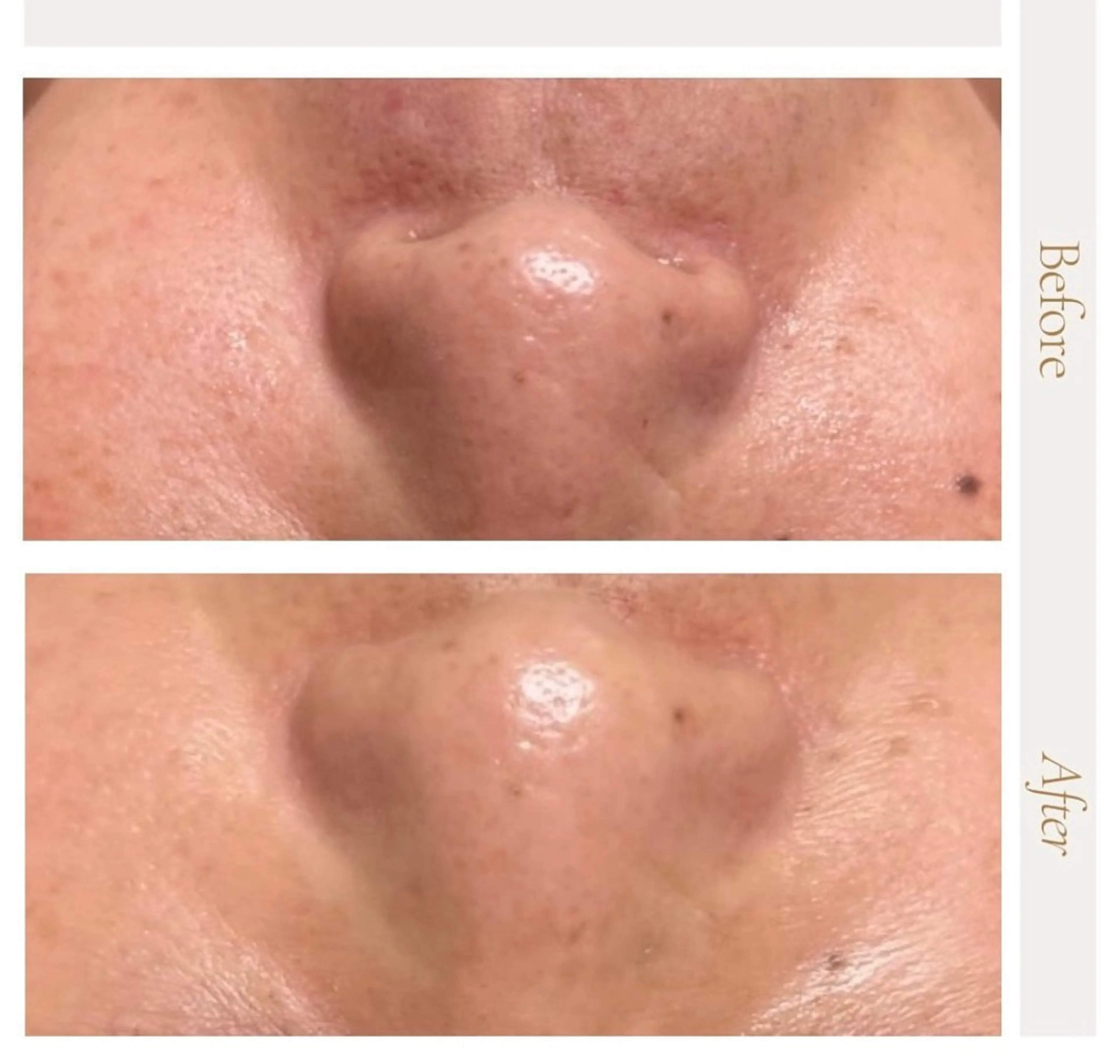 ピーリング＆脱毛 maoのエステ・リラクイメージ