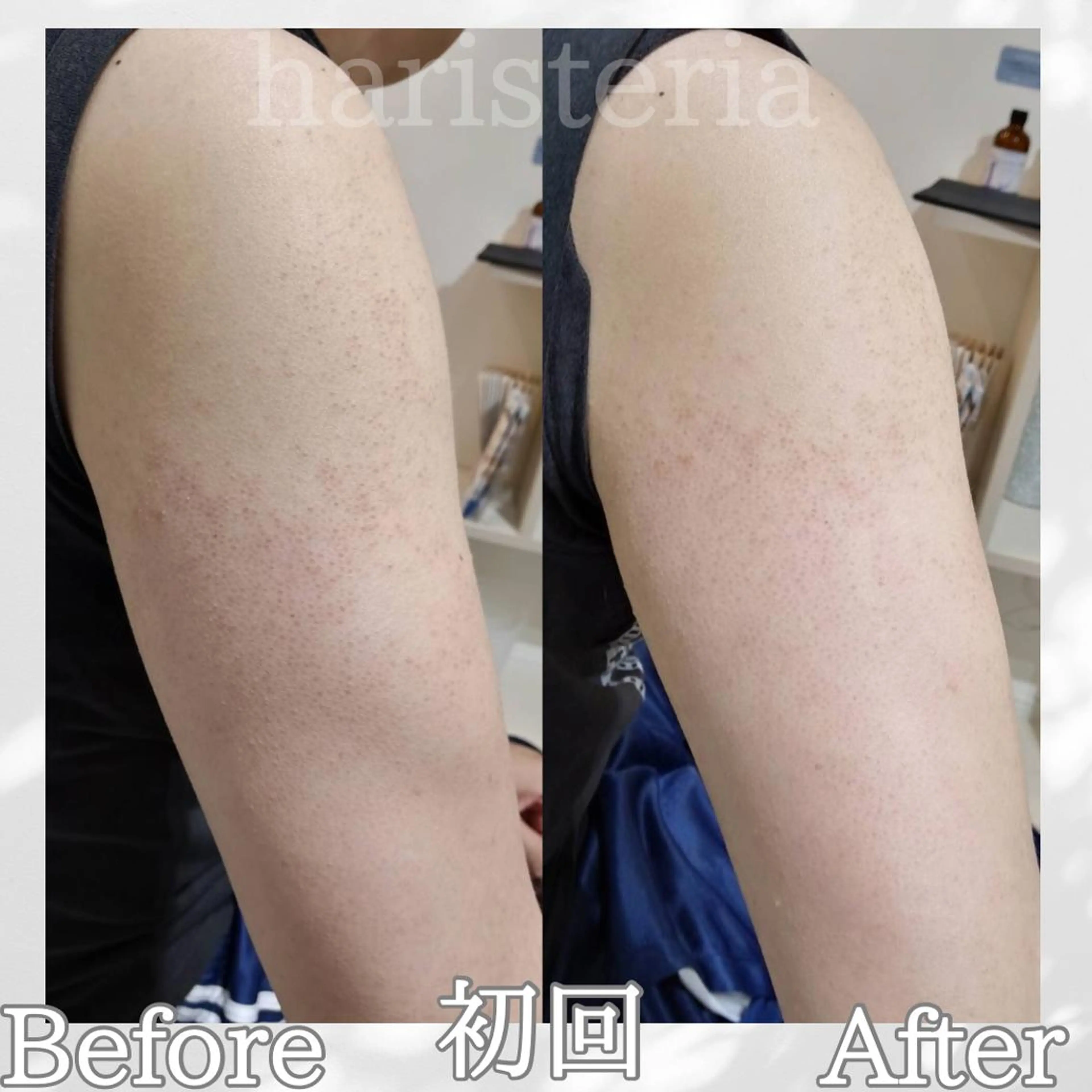 小顔・ツルツル素肌 ハリステリアのエステ・リラクイメージ