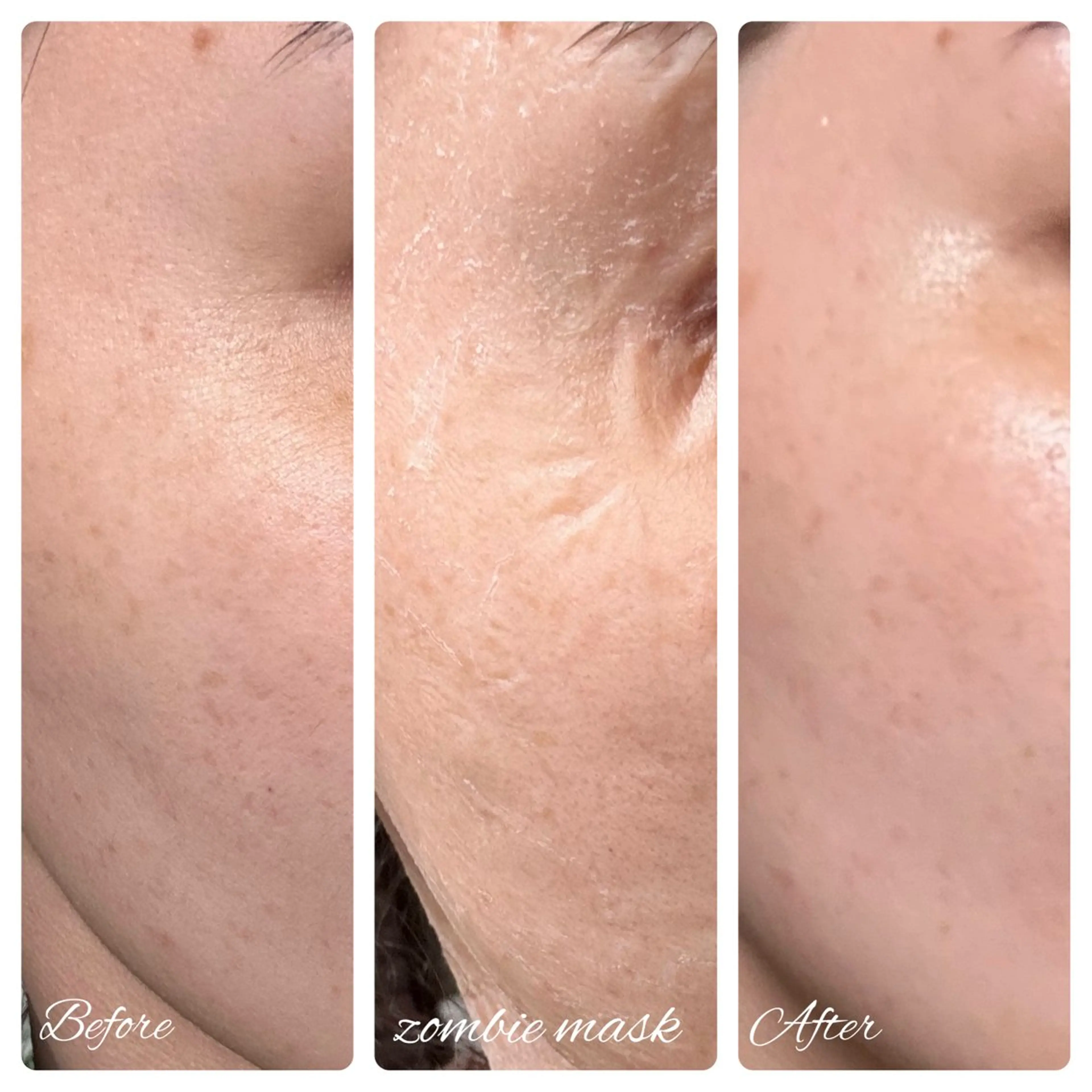 【カーボキシー炭酸ガスパック＋ゾンビマスク＋ハイドロジェリーマスク】最強スペシャルセット☆の写真