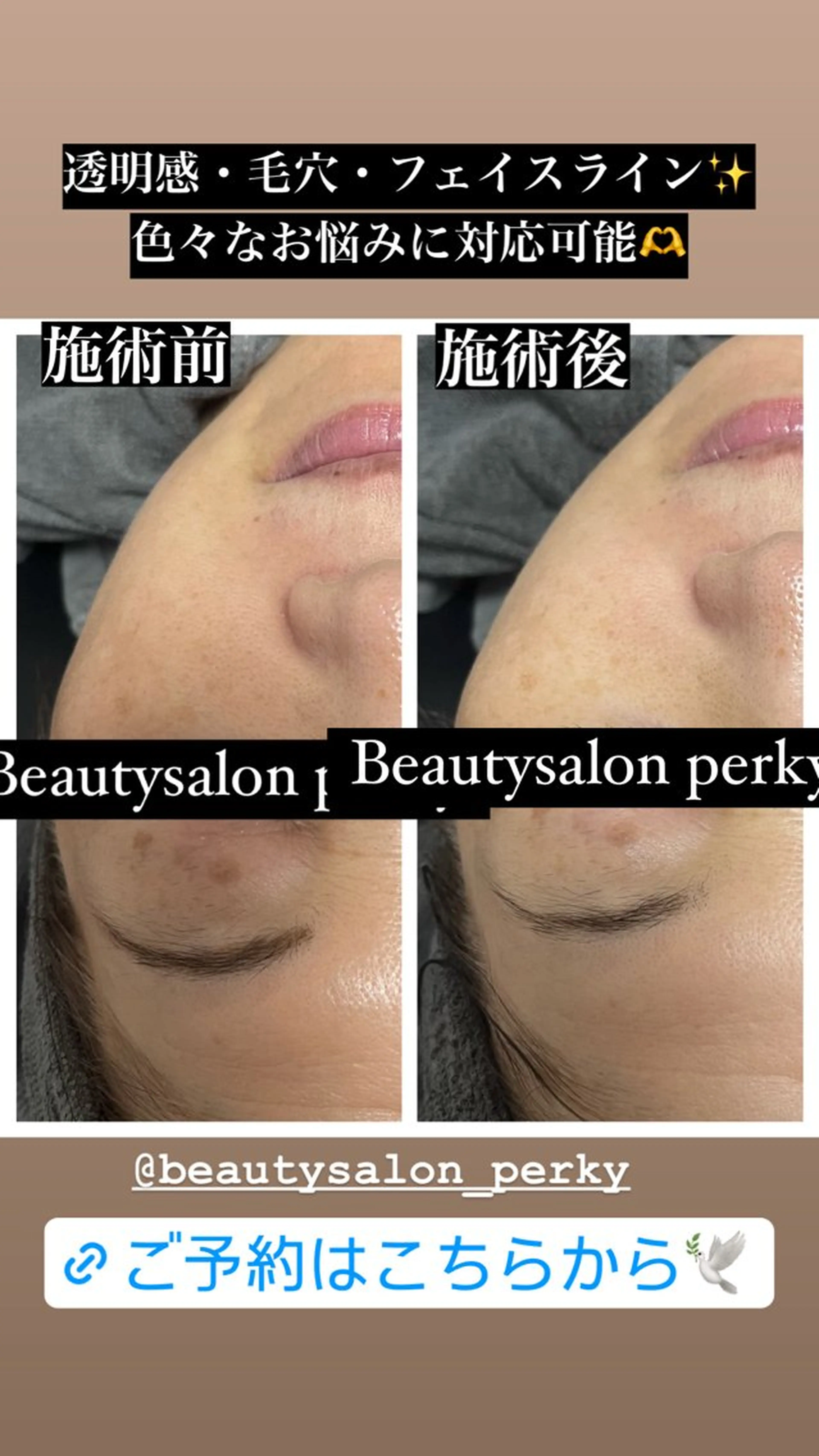 エステ perky所属・perky 羽島のマツエク・マツパデザイン