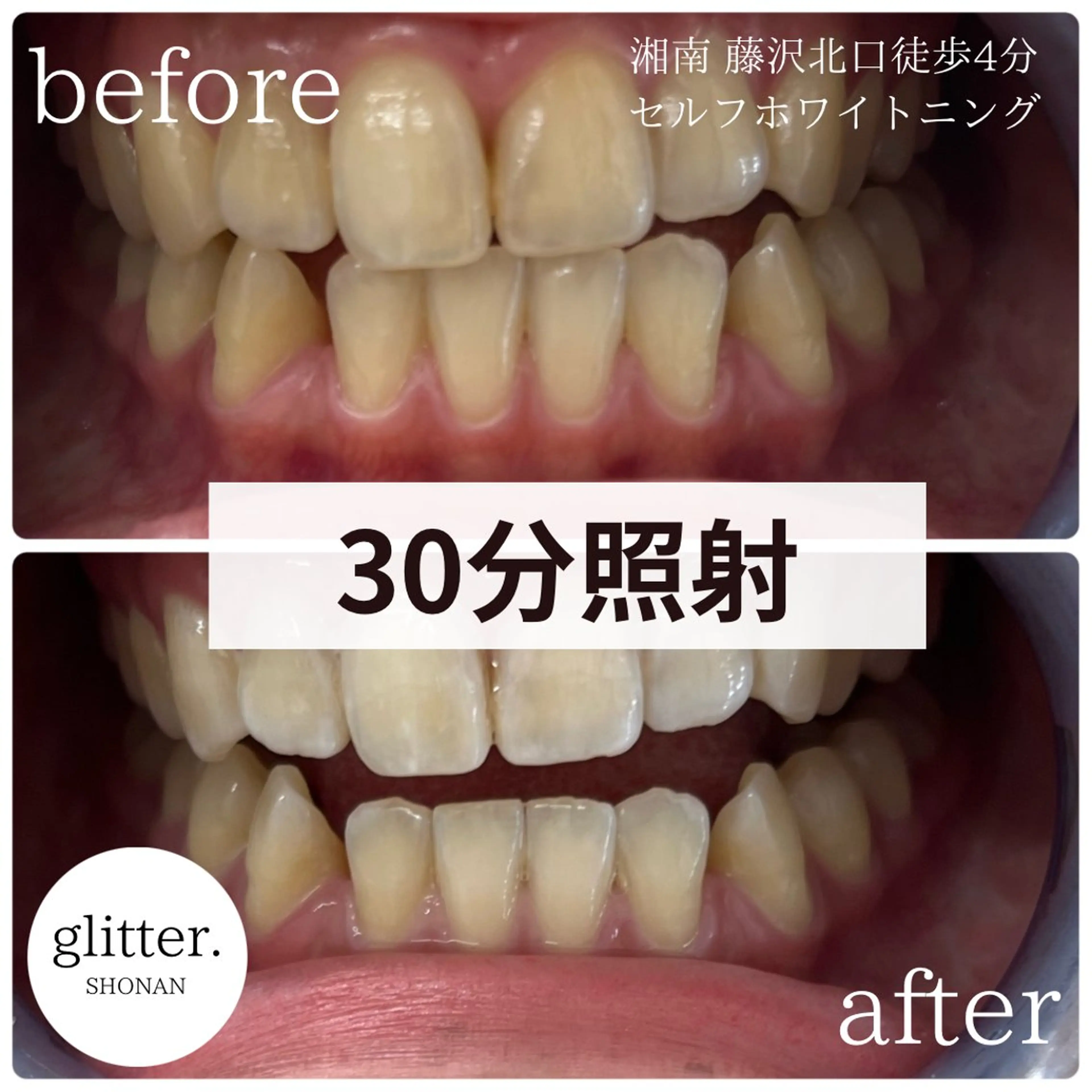 glitter.SHONAN所属・佐久間 茉弥のエステ・リラクイメージ