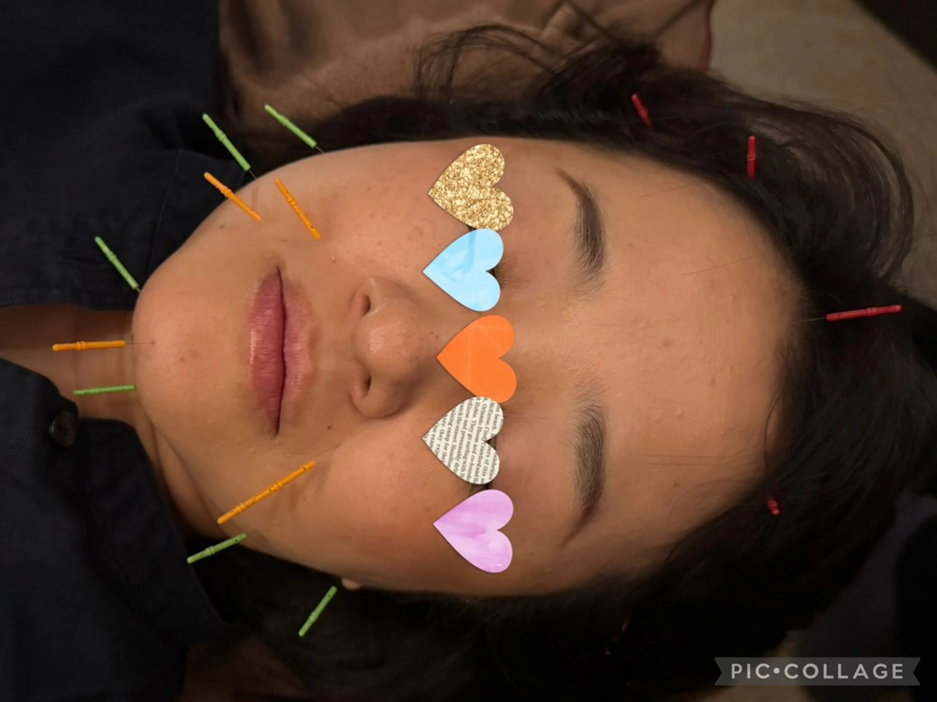 エステ Acupuncture  salon LINOA リノア鍼灸院所属・LINOAヘッドスパ 小顔ケア/逆子ケアのエステ・リラクイメージ