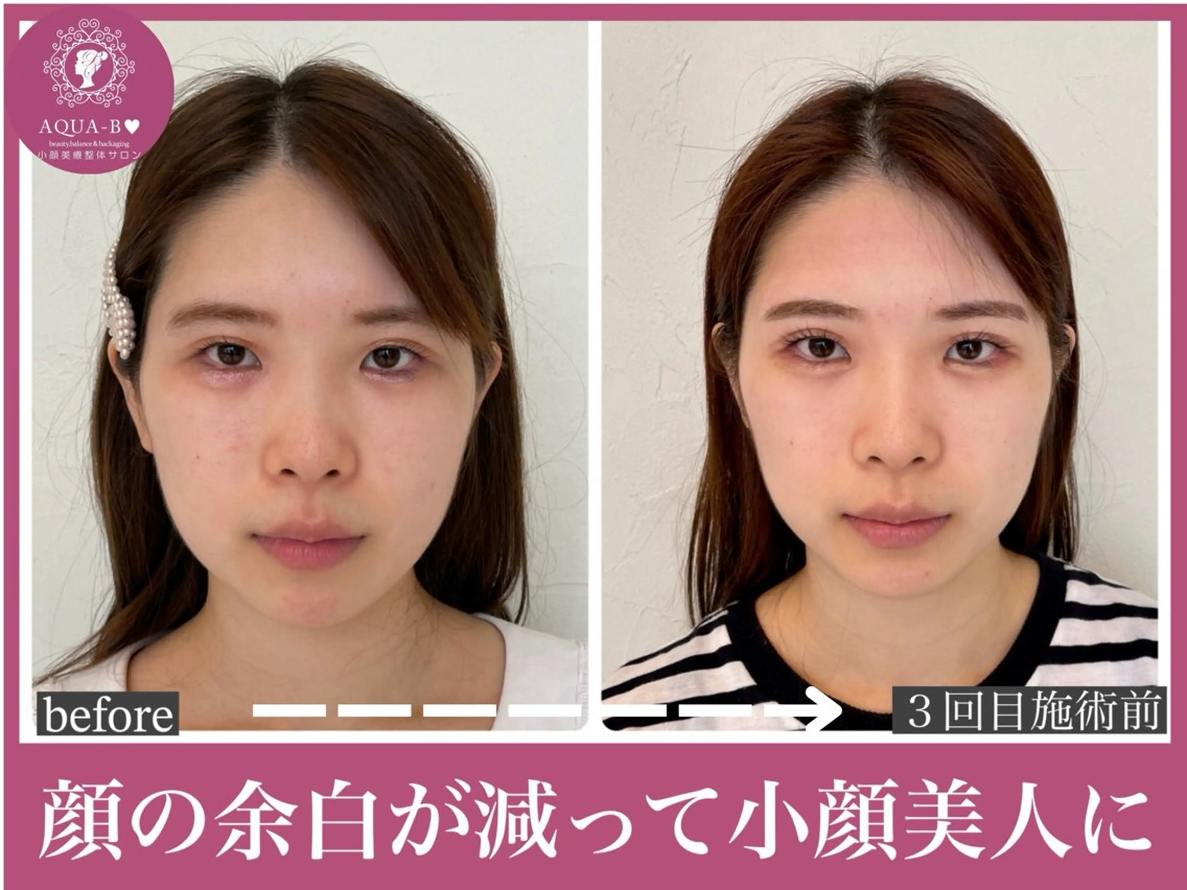 盛れる小顔矯正師 たく先生のエステ・リラクイメージ