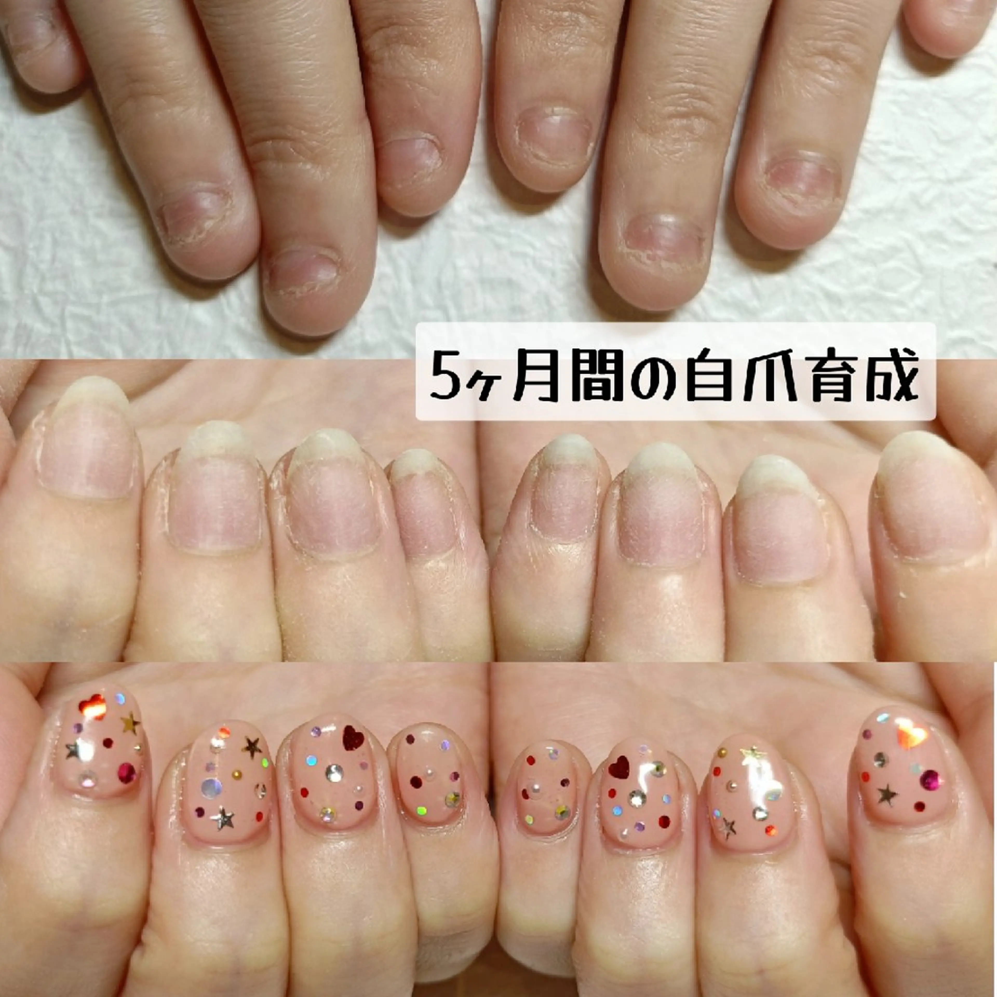 ネイル ハンドネイル ハンドケア 深爪矯正/爪育成ケア manie nailのネイルデザイン