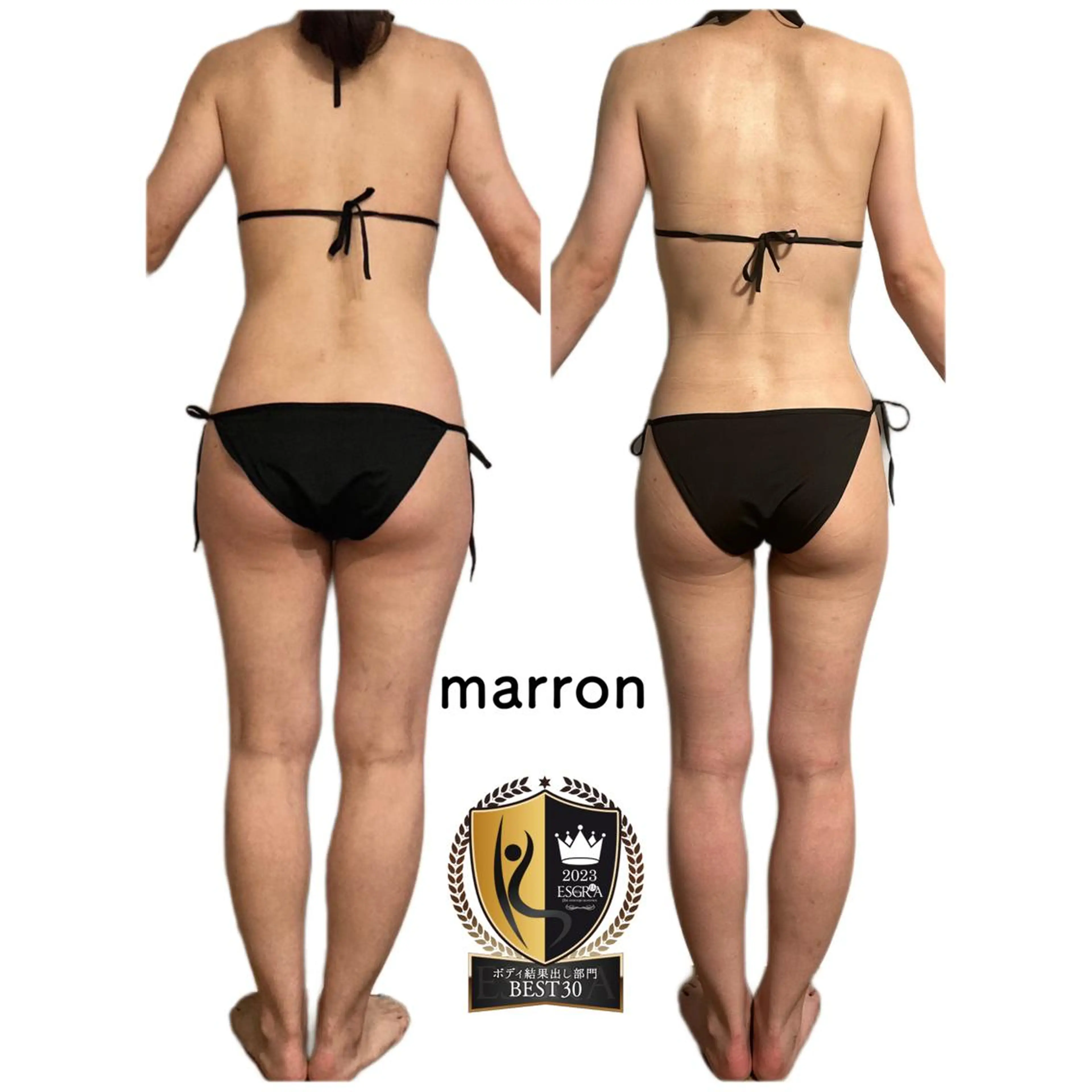 marron所属・痩身ハイパーナイフ ララピールリアボーテのエステ・リラクイメージ