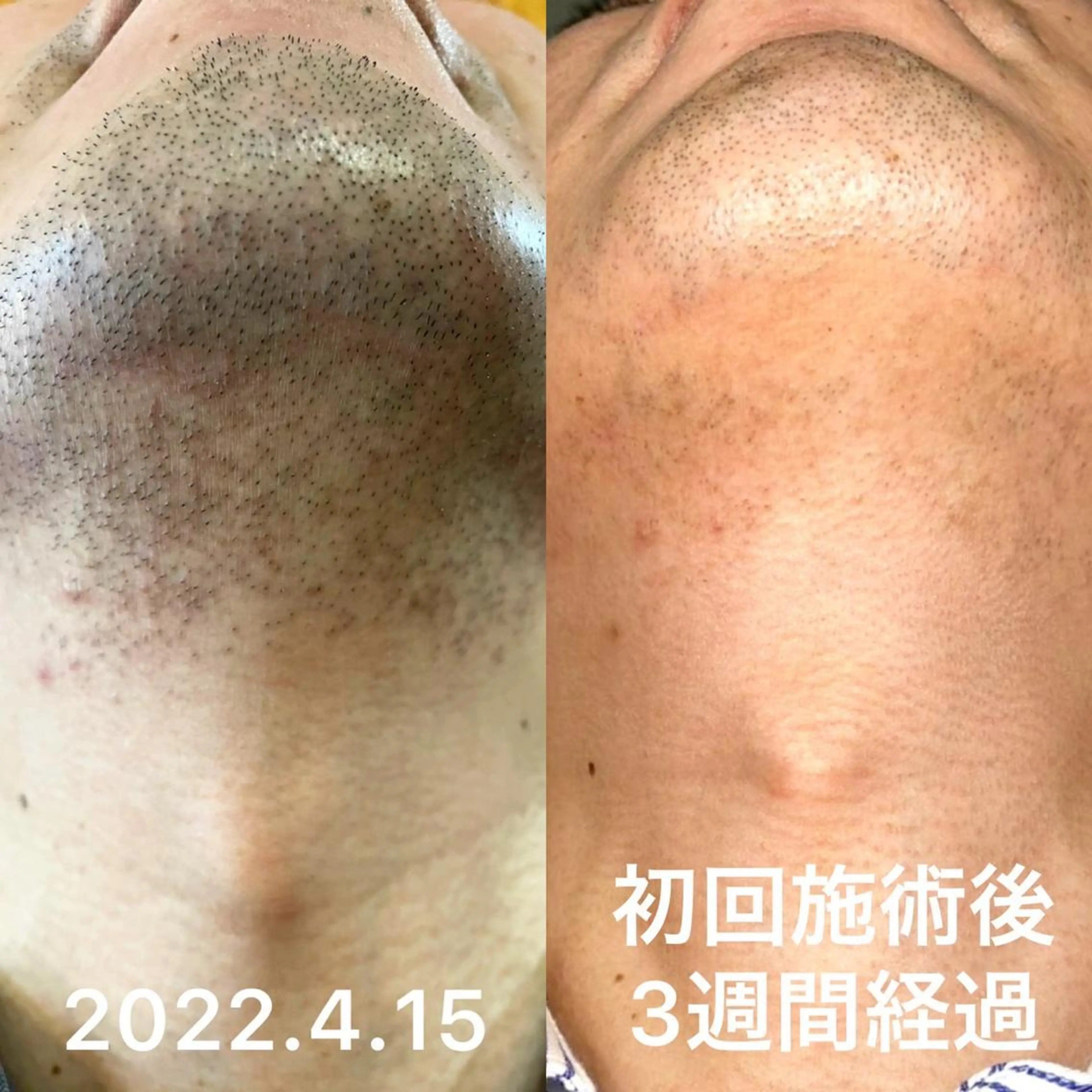 akua... 【肌質管理専門】のその他イメージ