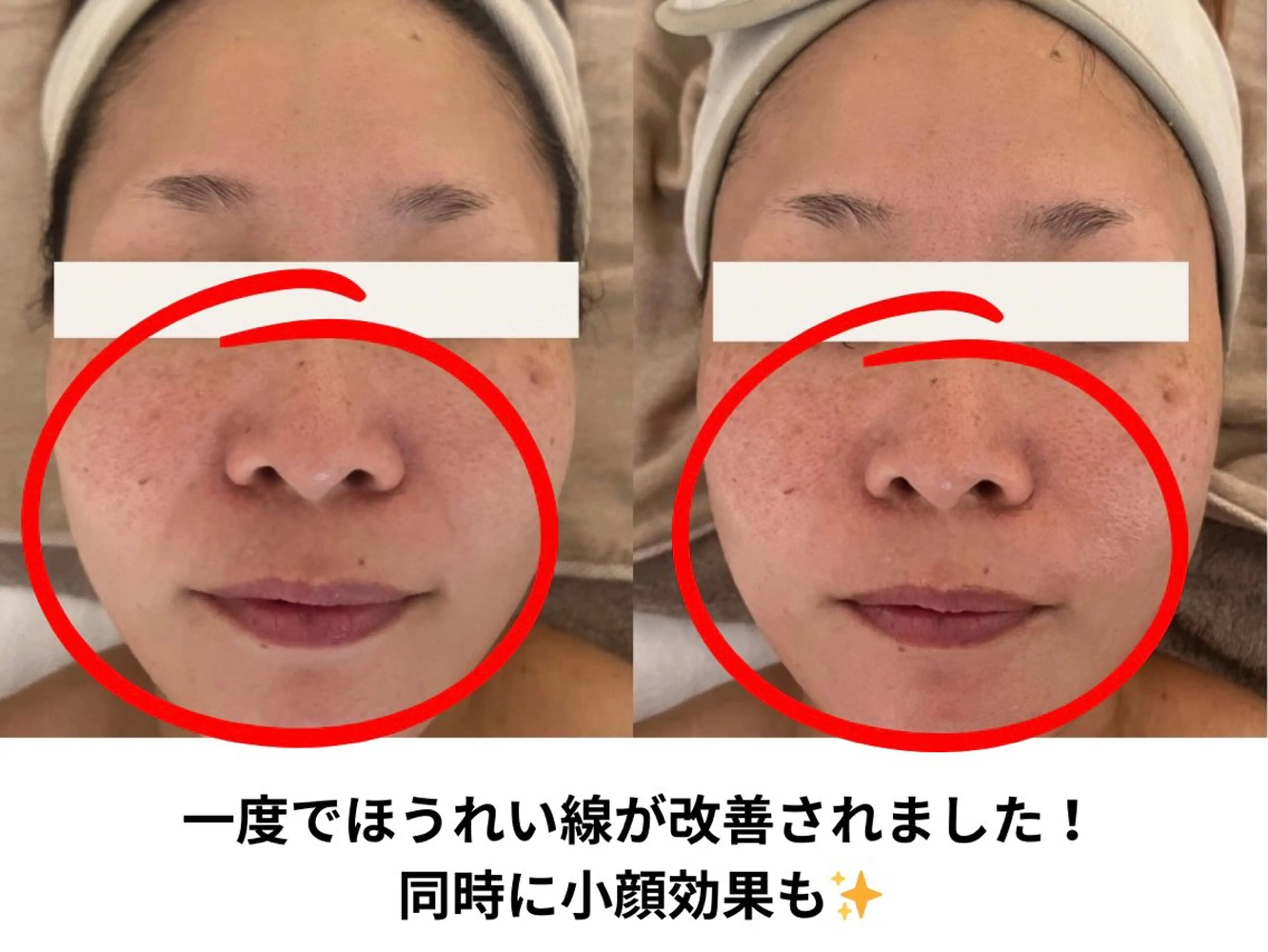 Total Beauty salon Bloom所属・肌育WISHpro 専門サロンBloomのエステ・リラクイメージ