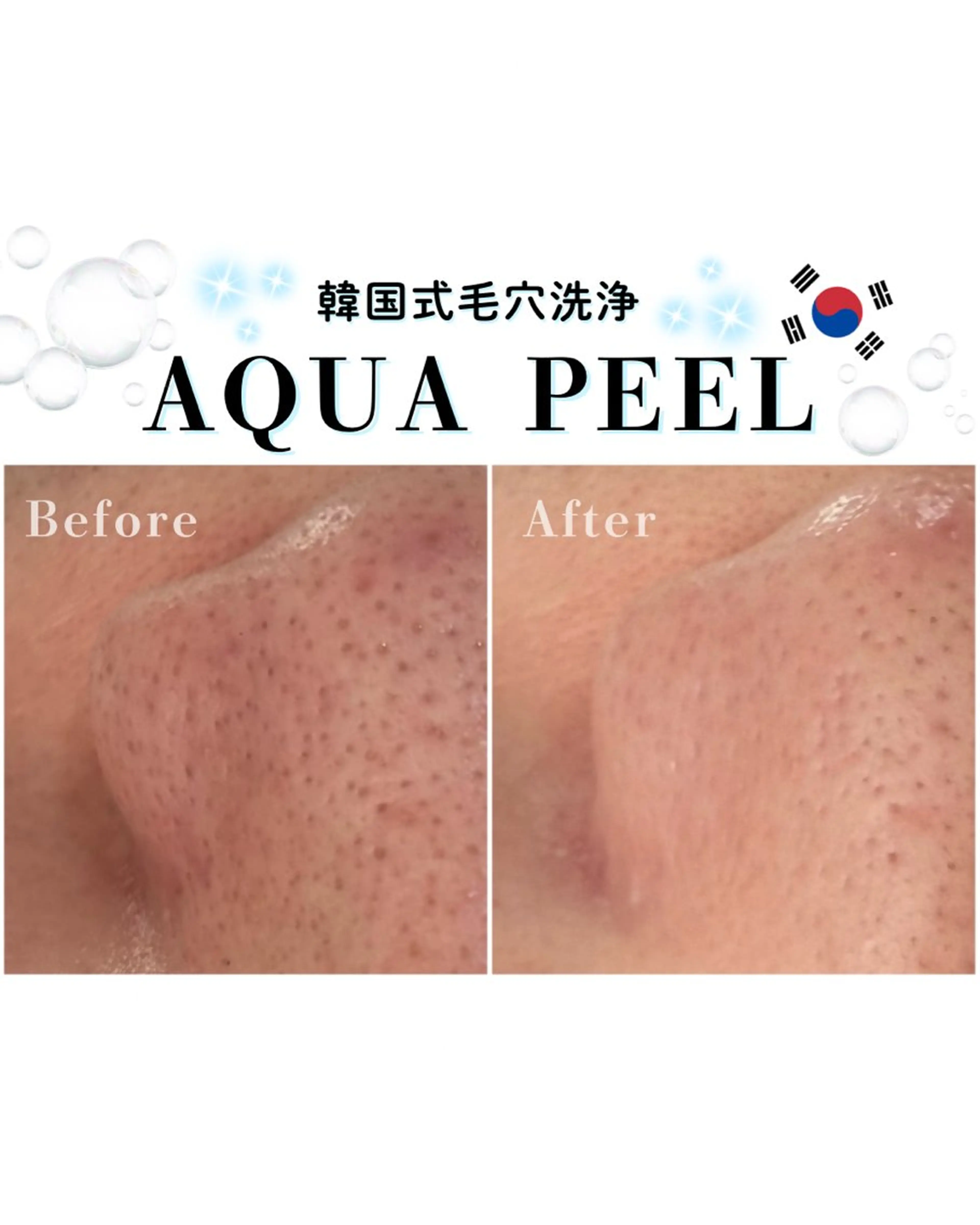 HETIY by Seoul所属・韓国肌管理🇰🇷 水光肌/肌質改善🫧のエステ・リラクイメージ