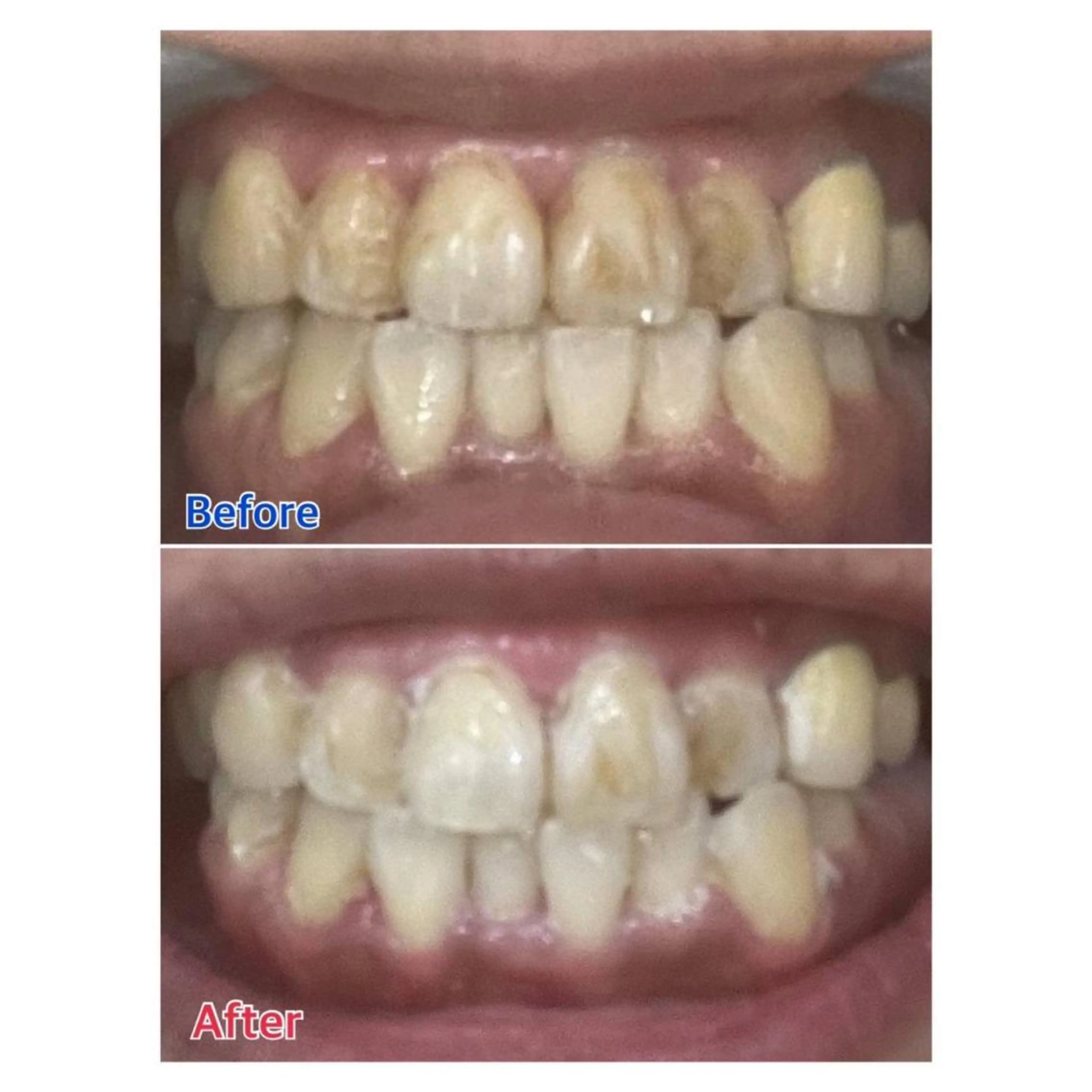 MBEAUTYSALON 千葉店・京成大久保所属・Melty 輝のその他イメージ