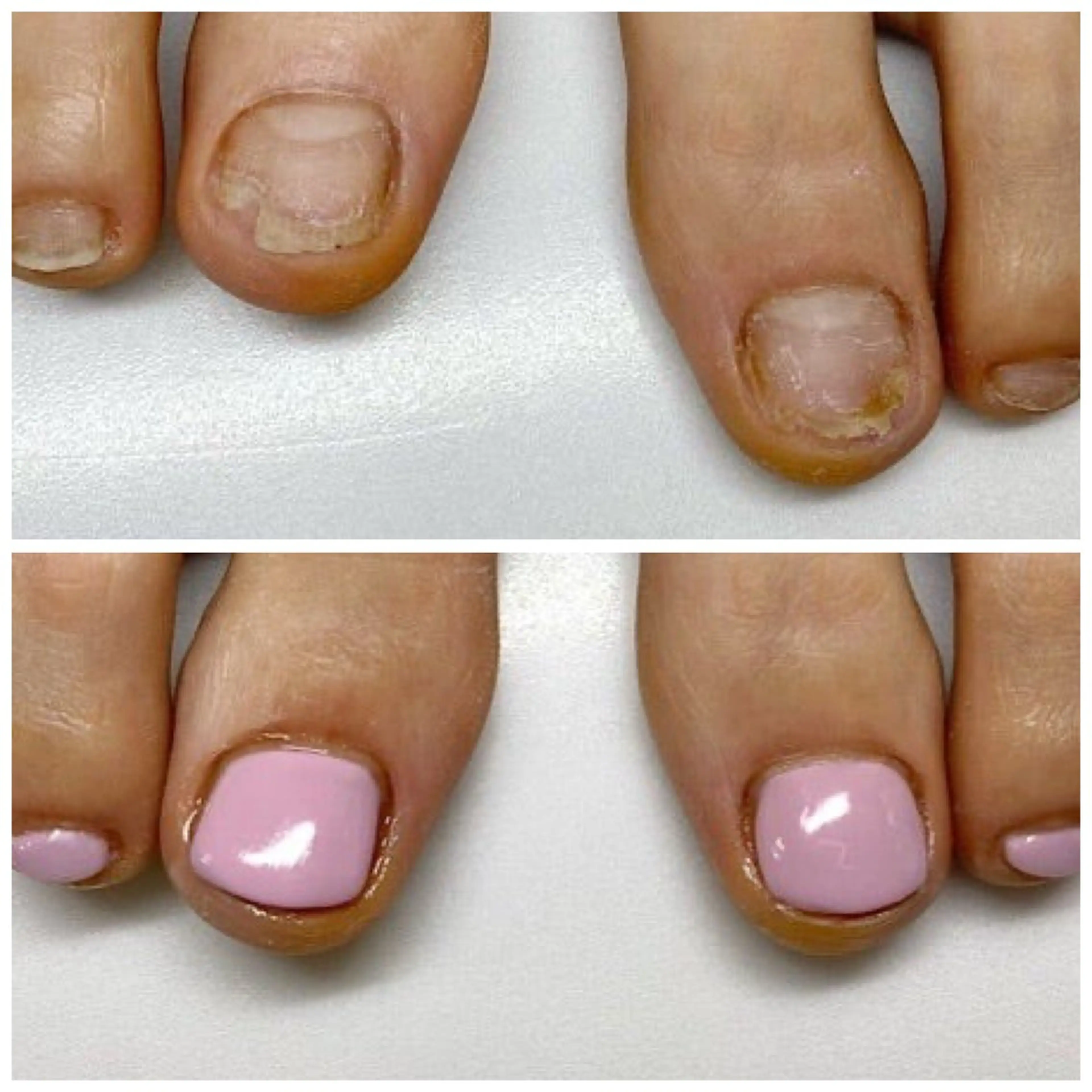 ネイル ネイルサロンアリューム所属・ネイルサロン アリュームのネイルデザイン