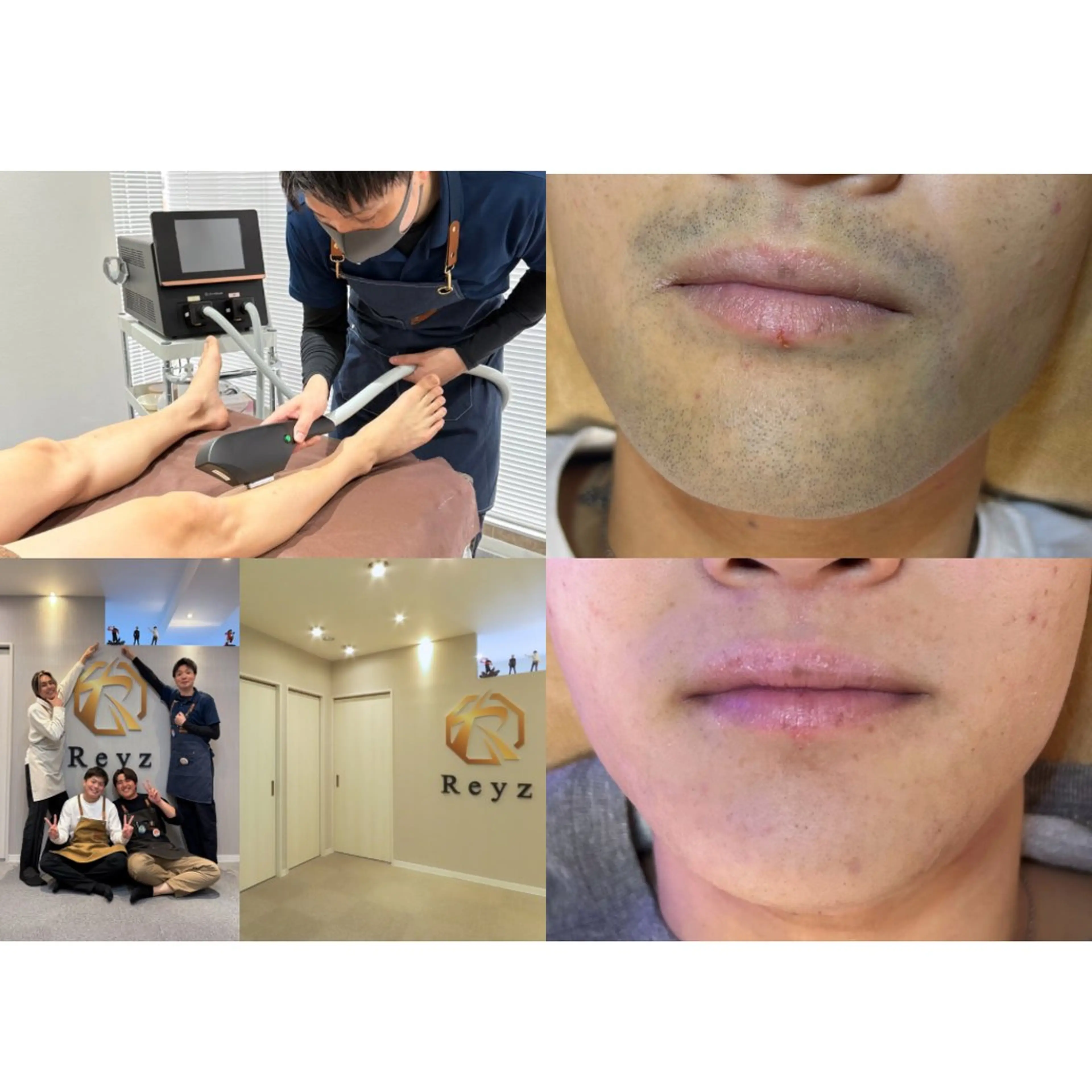 メンズ脱毛サロンReyz（レイズ）所属・熊本メンズ脱毛サロン Reyz（レイズ）のエステ・リラクイメージ