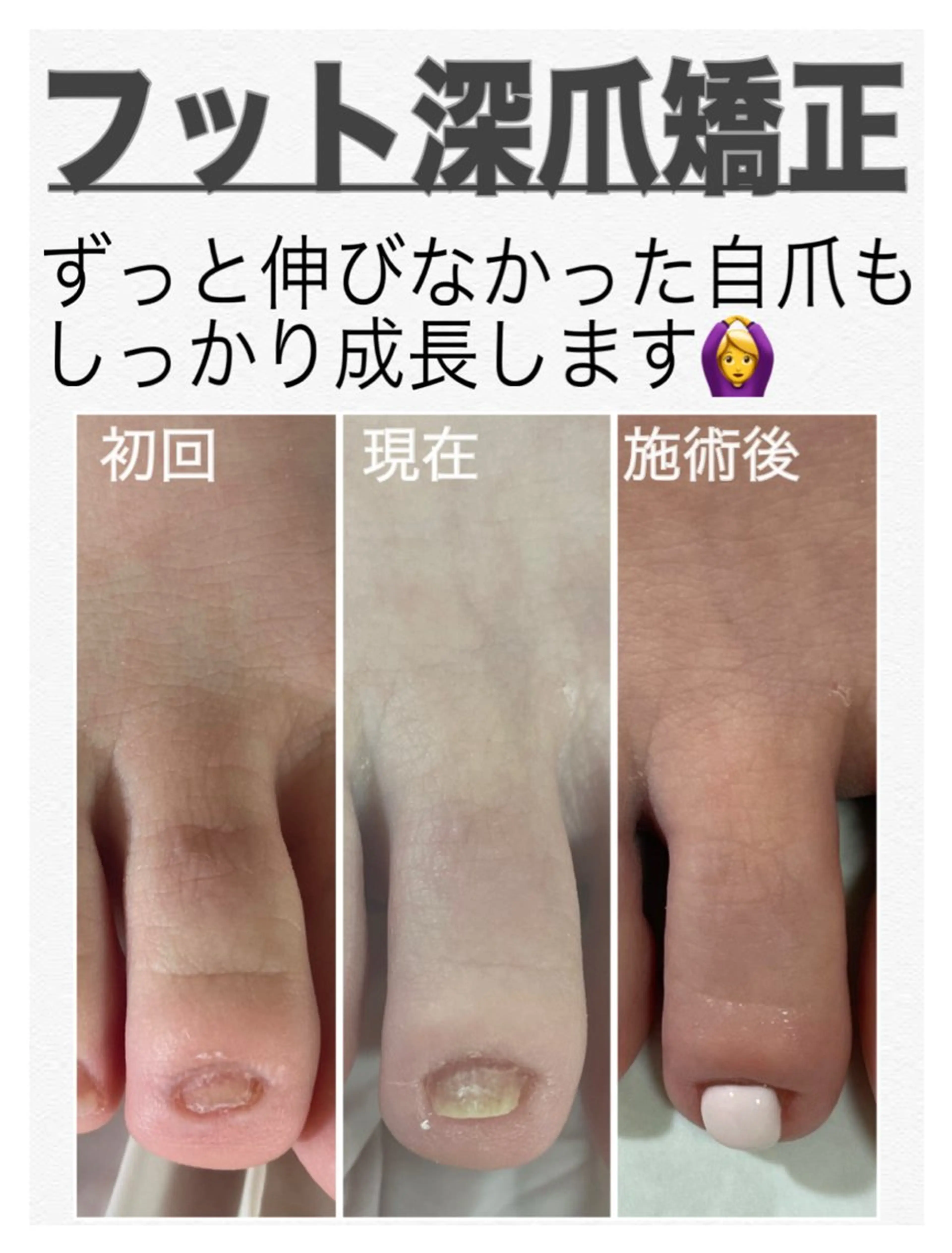 ネイル フットネイル petillant所属・nail salon petillantのネイルデザイン