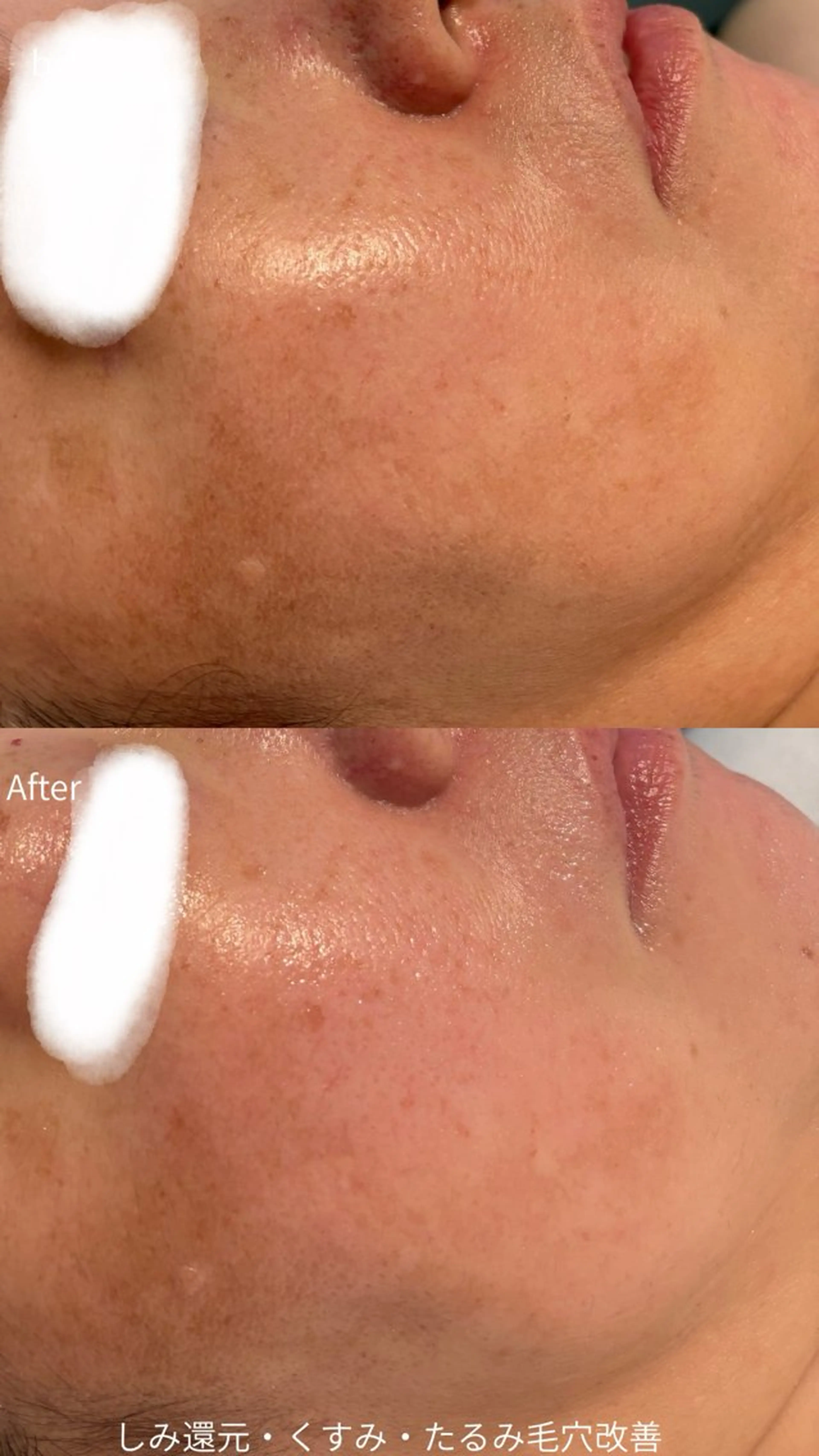 エステ リラク デ・アイム塚口所属・肌質/体質改善 久下玲菜のエステ・リラクイメージ