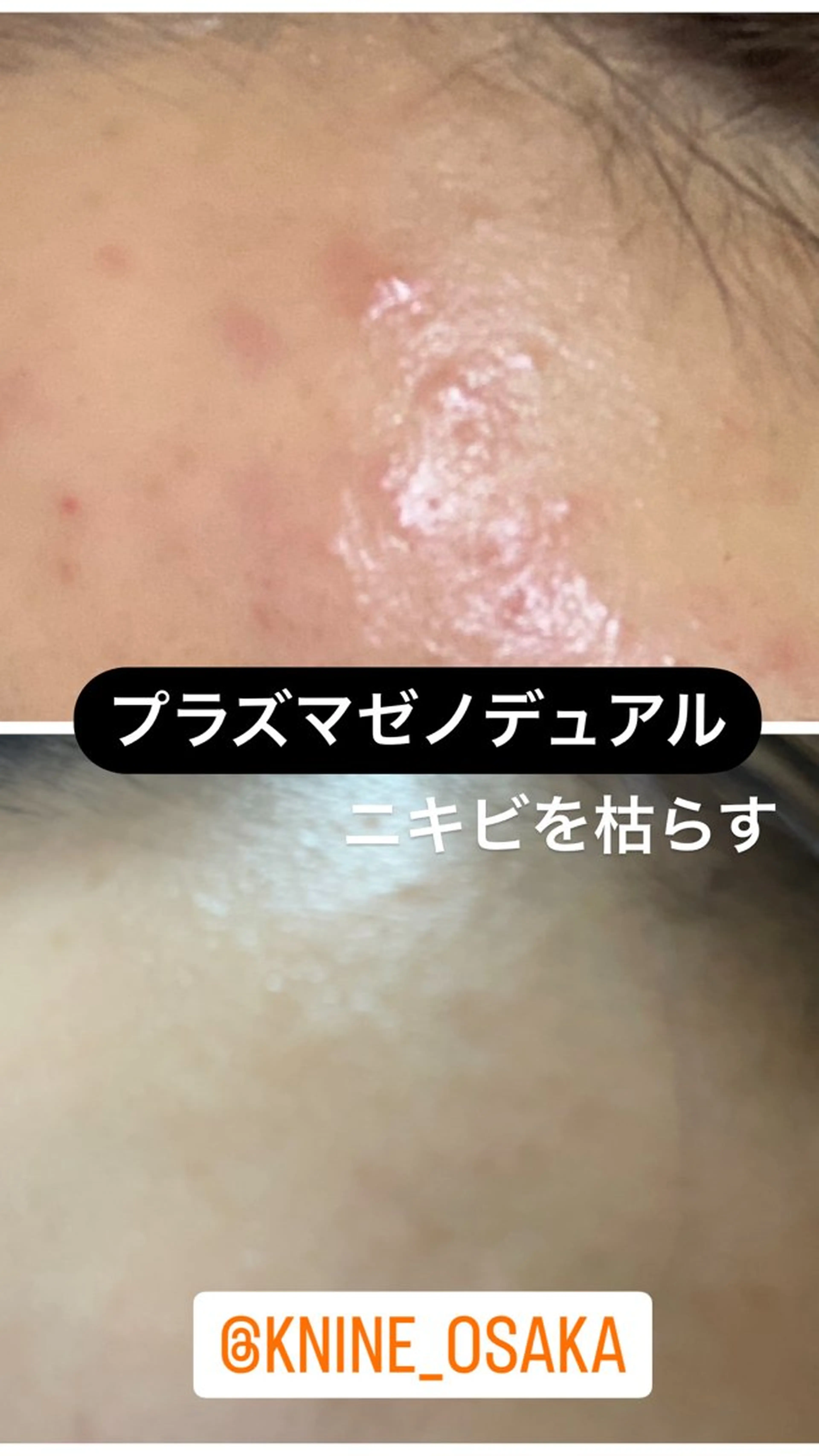 Knine所属・Knine 心斎橋店のエステ・リラクイメージ