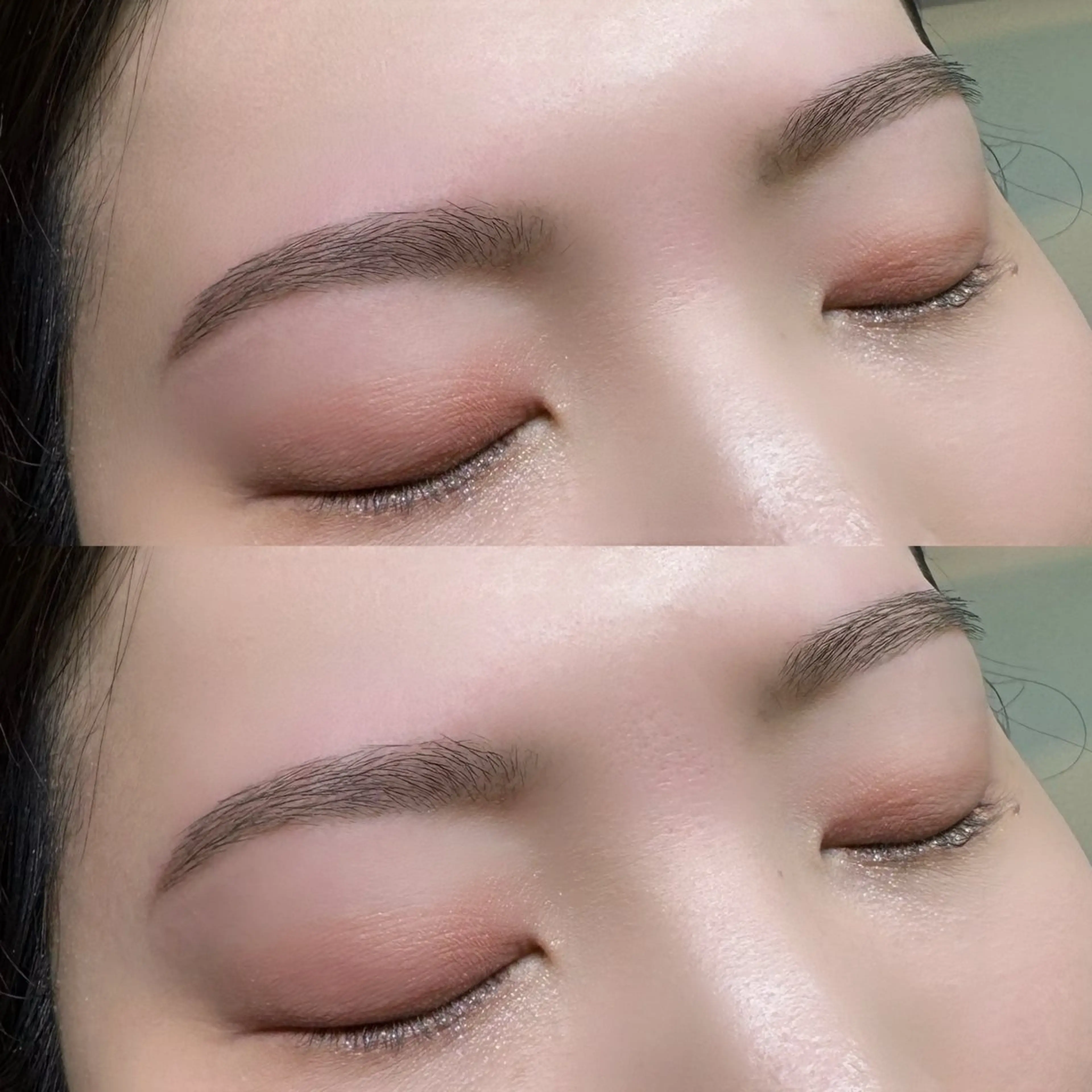 アイブロウ脱毛の写真