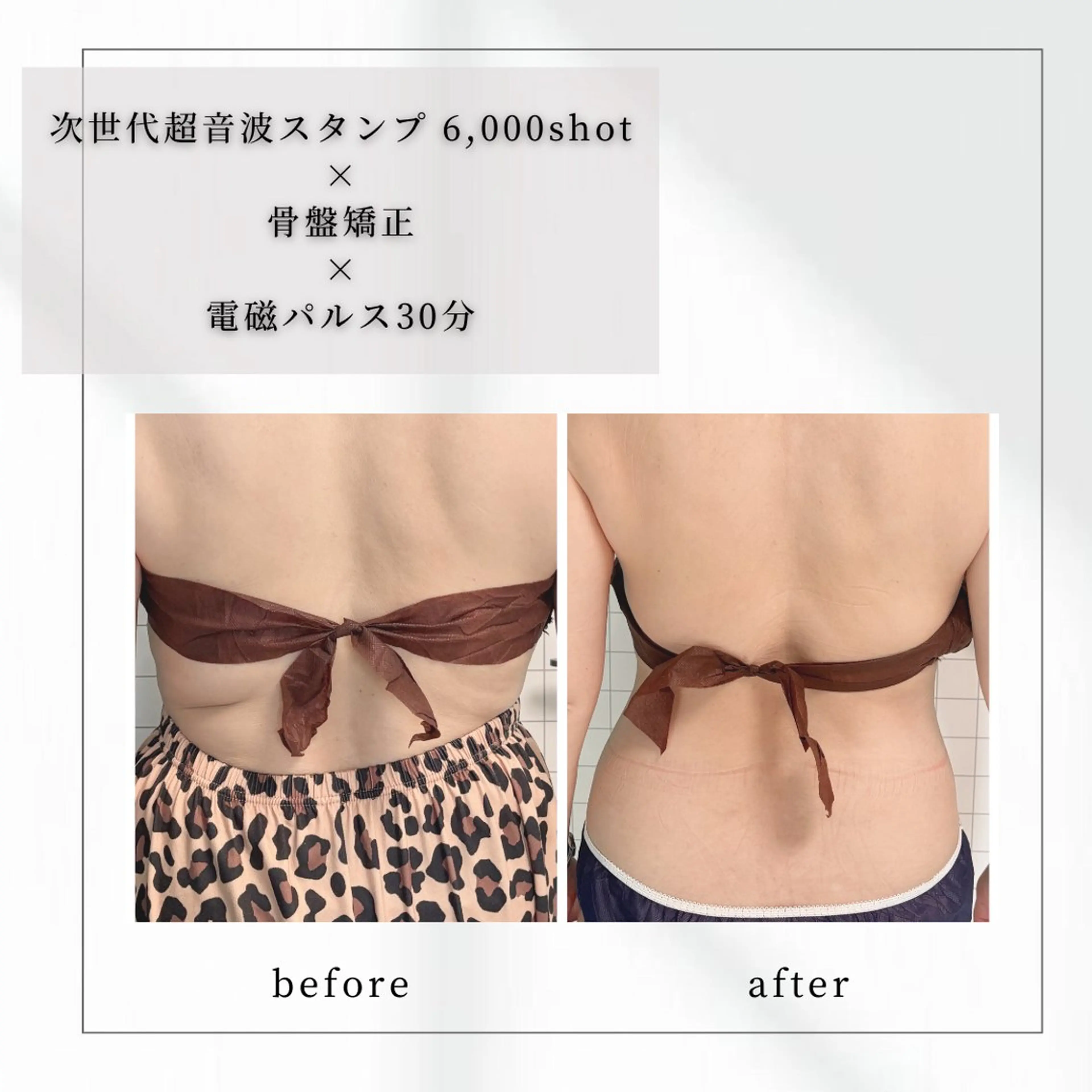 小顔矯正専門店 【RED】池田のエステ・リラクイメージ