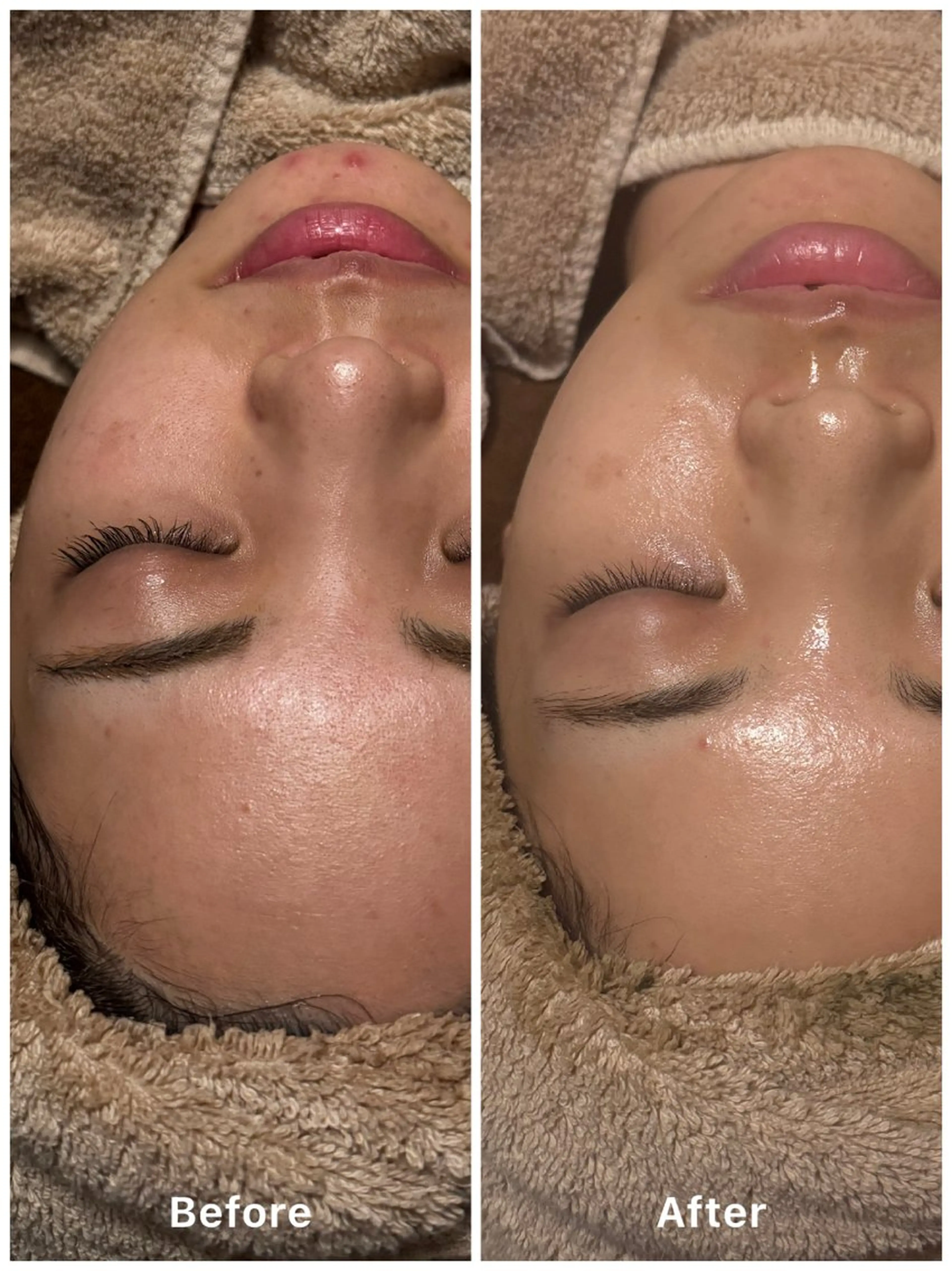 エステ Flourb所属・ハーブピーリング専門 サロンFlourbのエステ・リラクイメージ