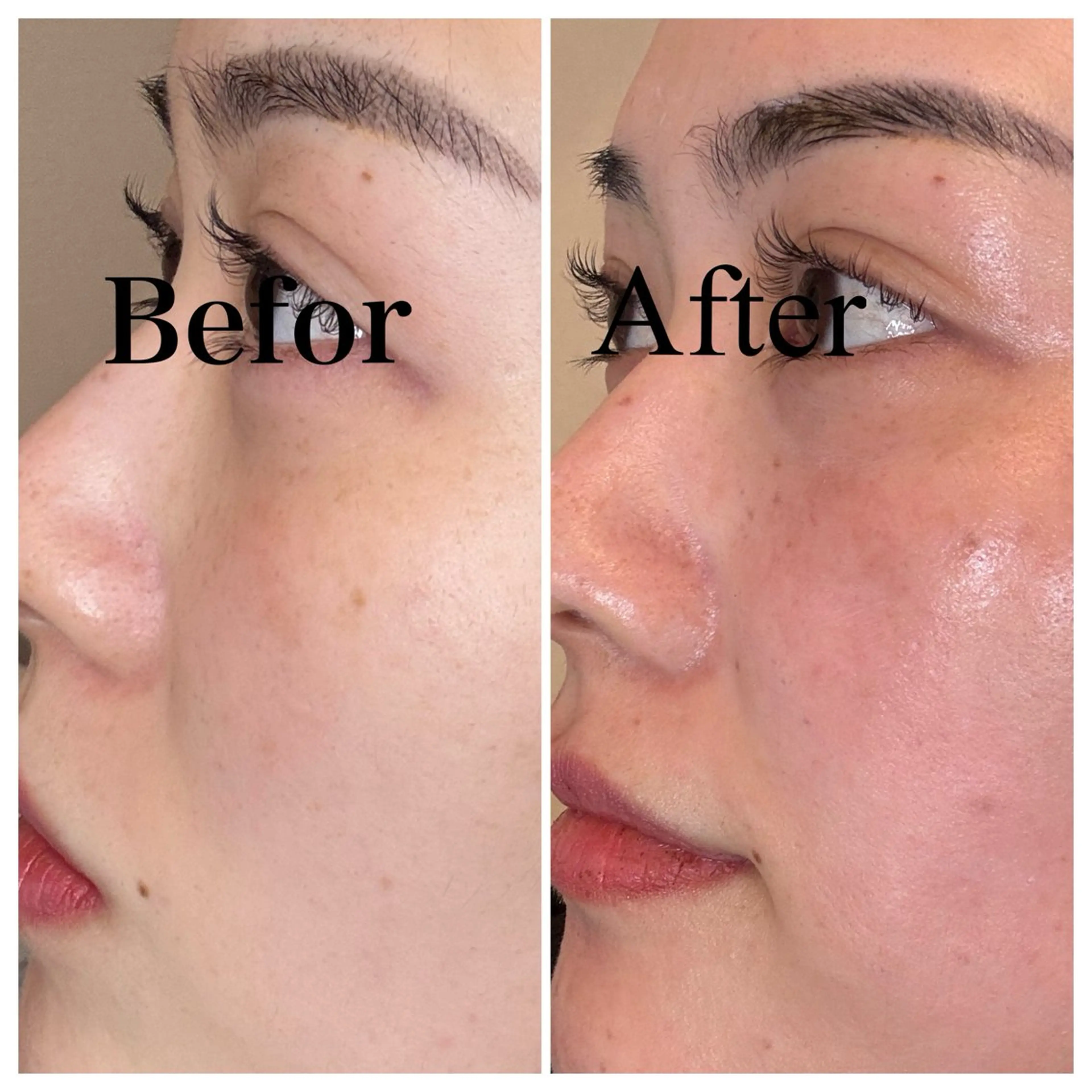 エステ 美肌管理サロン　ペルボヌール所属・韓国美肌管理サロン ペルボヌールのエステ・リラクイメージ