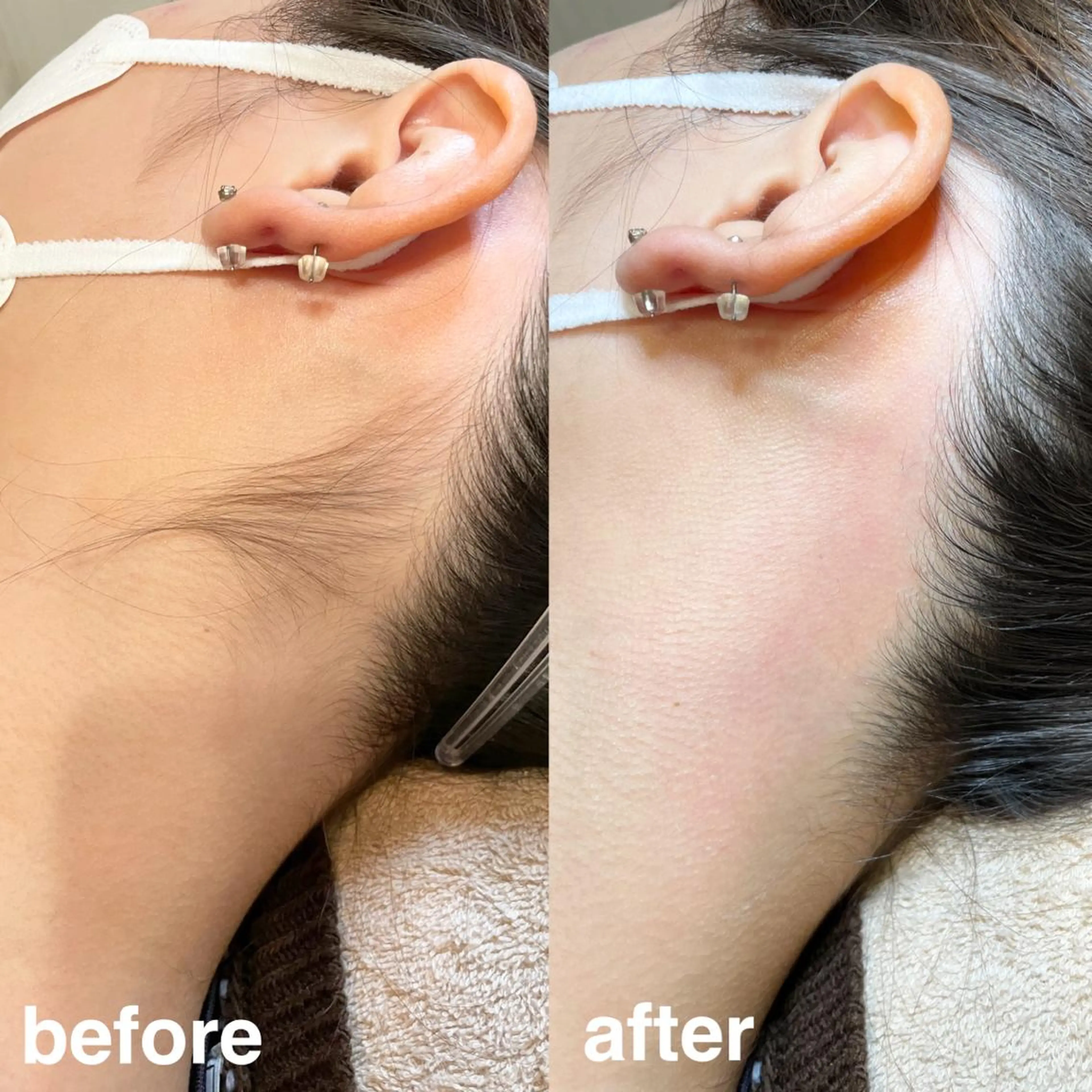 脱毛 ナチュラル眉まつ毛 ／ラウレアの眉毛・アイブロウイメージ