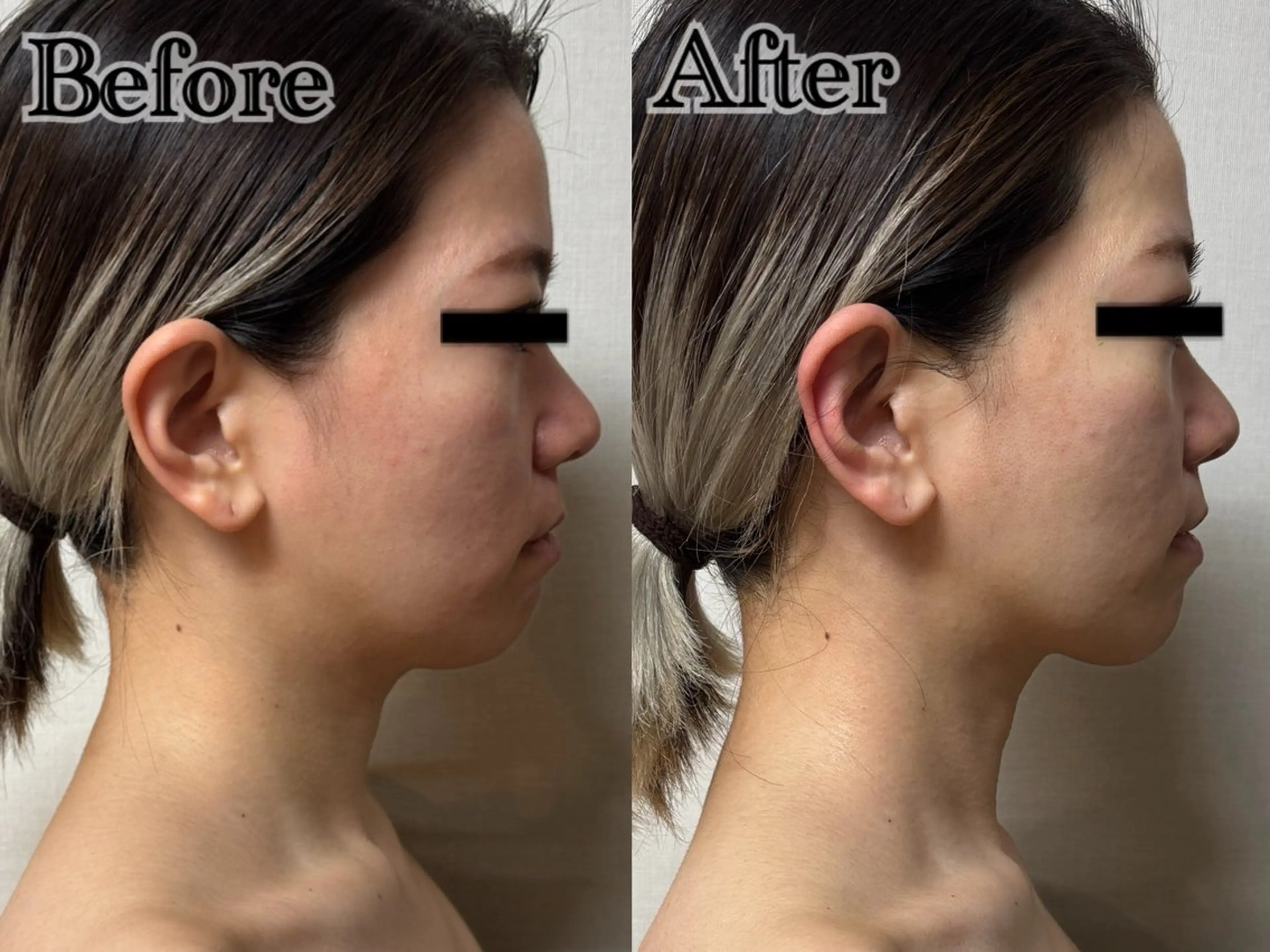 エステ 六本木脱毛andS 店長Sachiのエステ・リラクイメージ