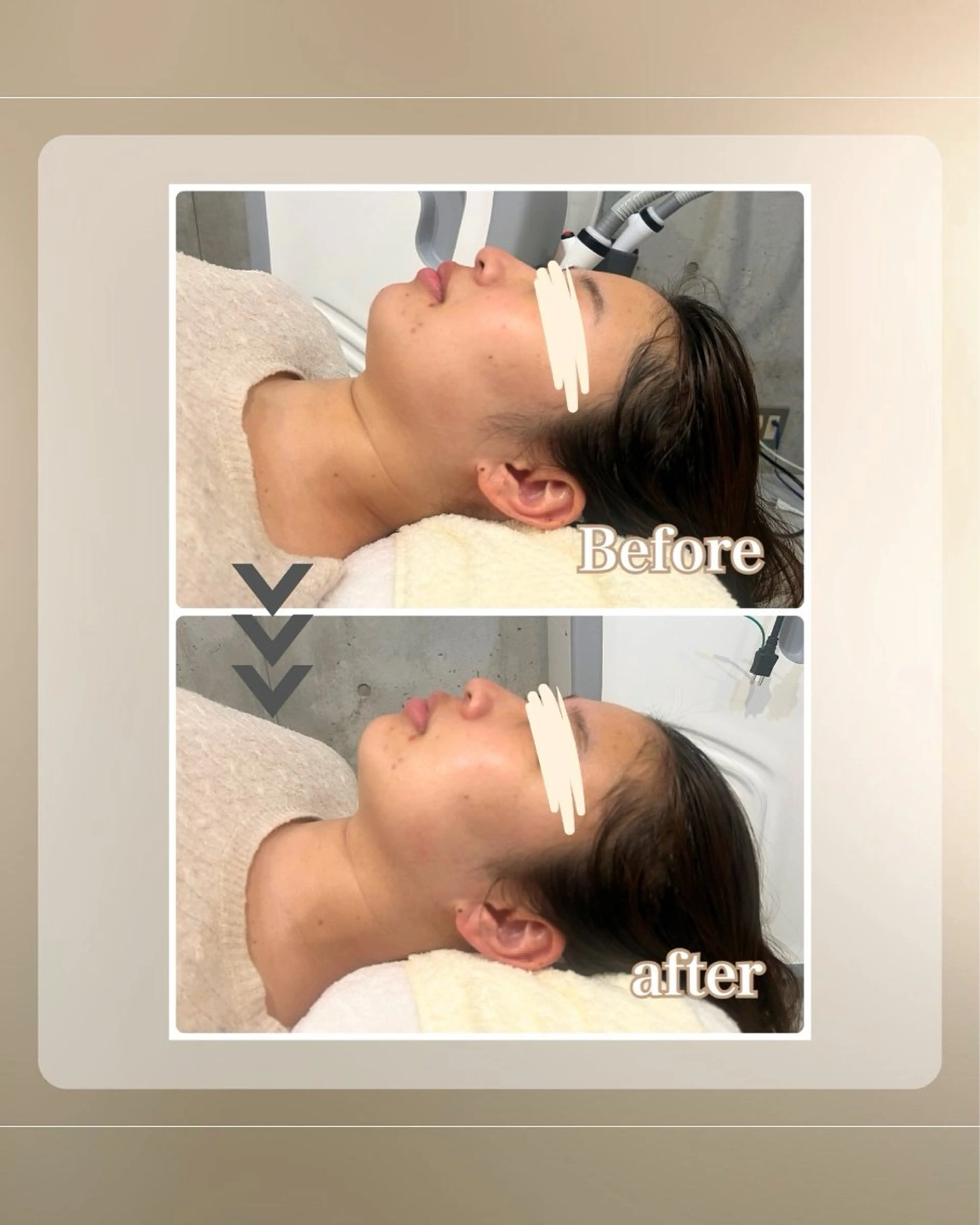 エステ Salon ÉTOA【サロンエトア】所属・Salon ÉTOA harukaのエステ・リラクイメージ